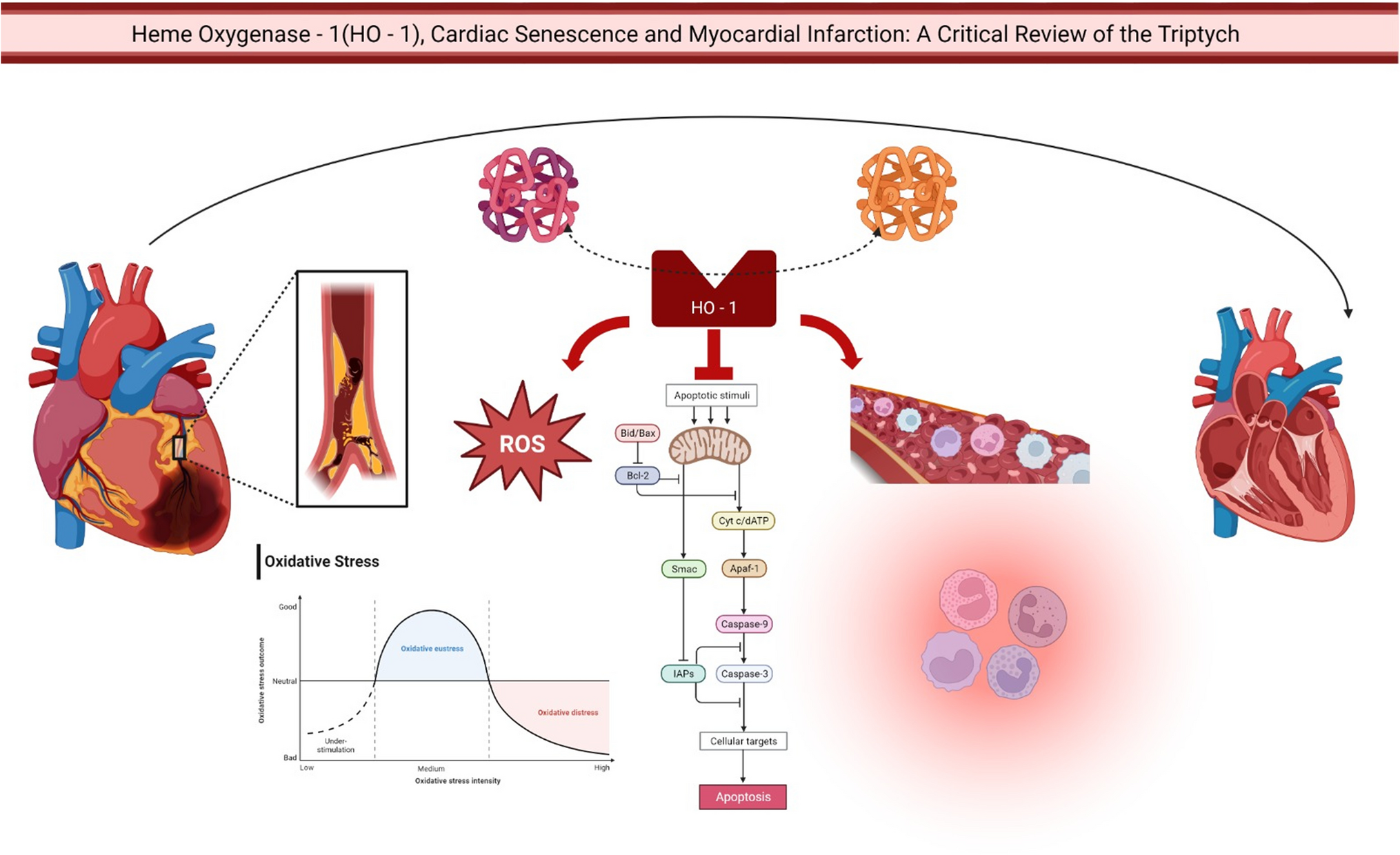Heme Oxygenase-1, Cardiac Senescence, and Myocardial Infarction: A Critical Review of the Triptych