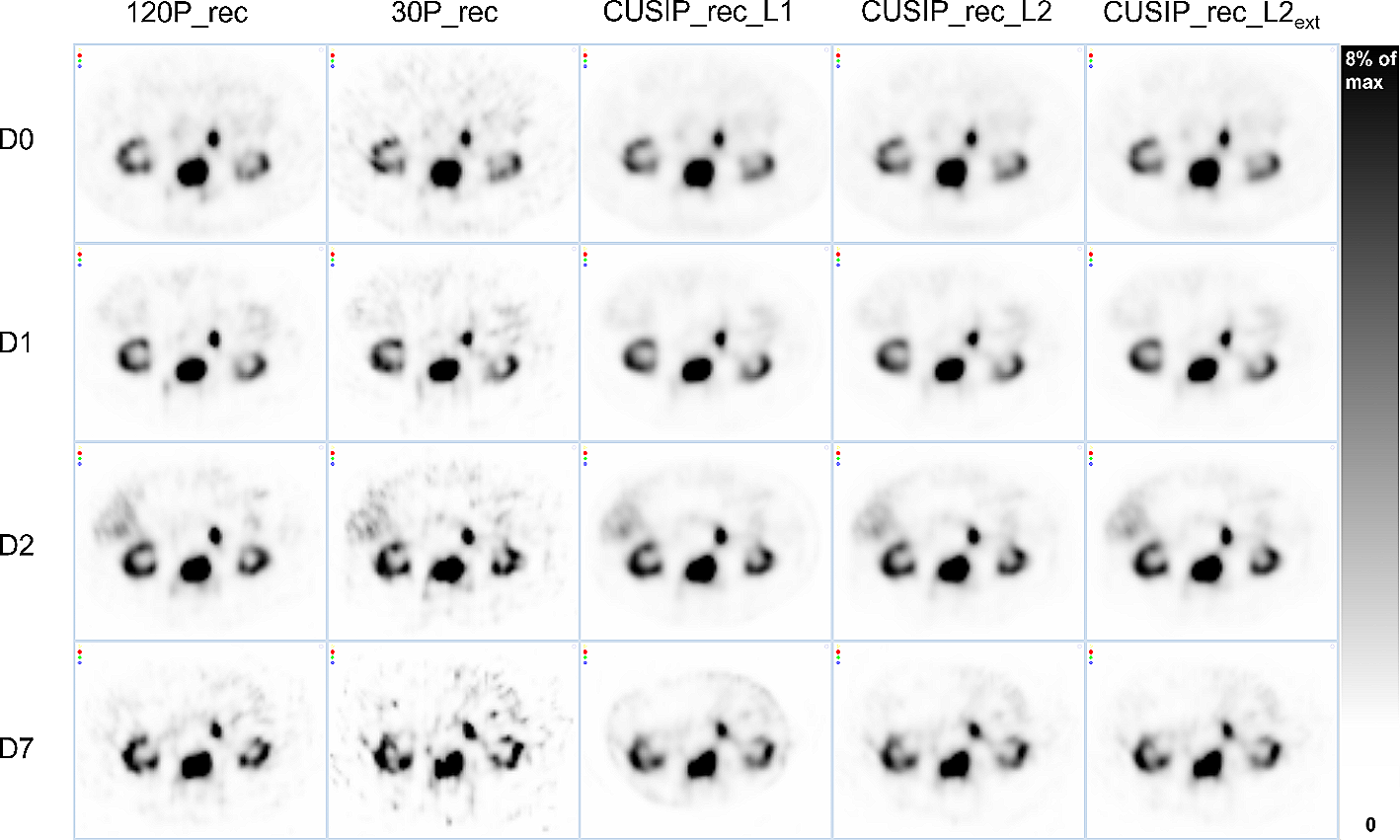Improvements of 177Lu SPECT images from sparsely acquired projections by reconstruction with deep-learning-generated synthetic projections