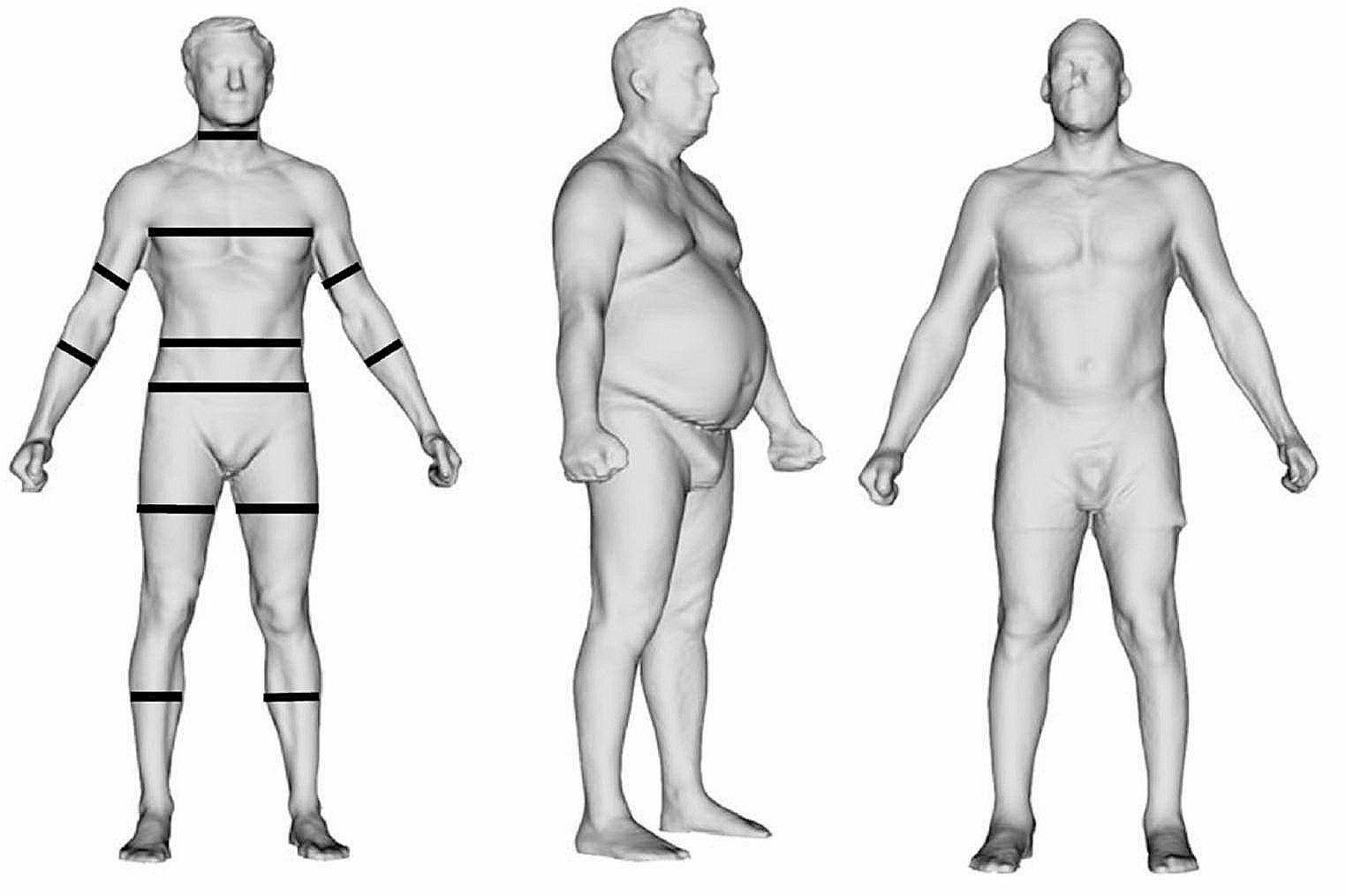 Strengths and Limitations of BMI in the Diagnosis of Obesity: What is the Path Forward?