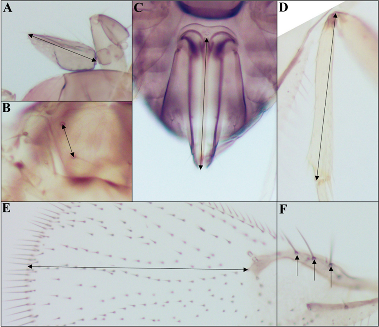 Body Part Selection for Size Classification of Two Trichogramma Species