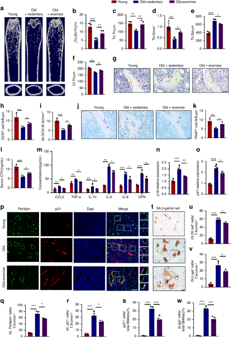 PCLAF induces bone marrow adipocyte senescence and contributes to skeletal aging