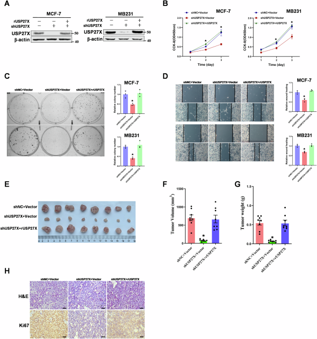 Phosphorylation of USP27X by PIM2 promotes glycolysis and breast cancer progression via deubiquitylation of MYC