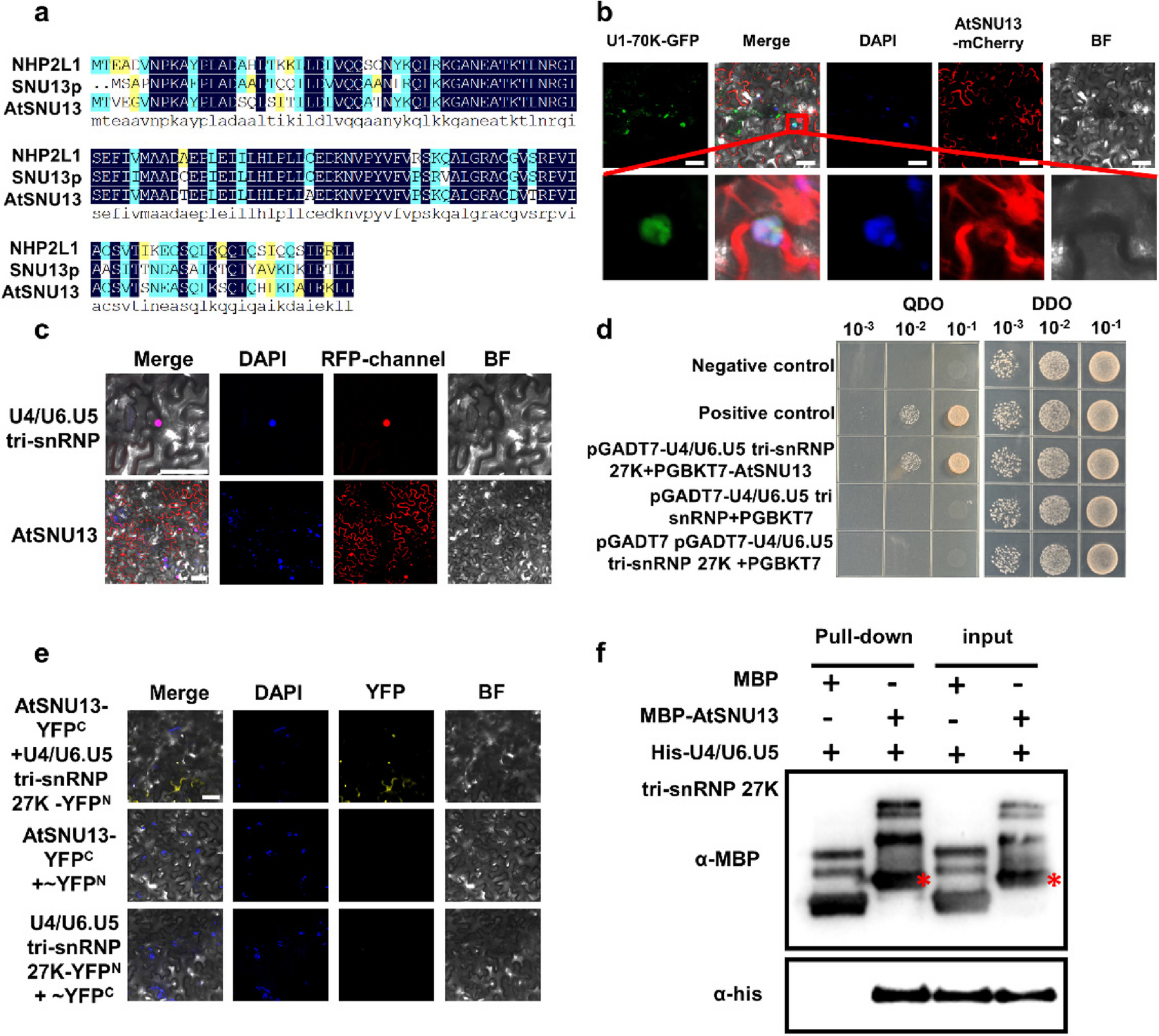 AtSNU13 modulates pre-mRNA splicing of RBOHD and ALD1 to regulate plant immunity
