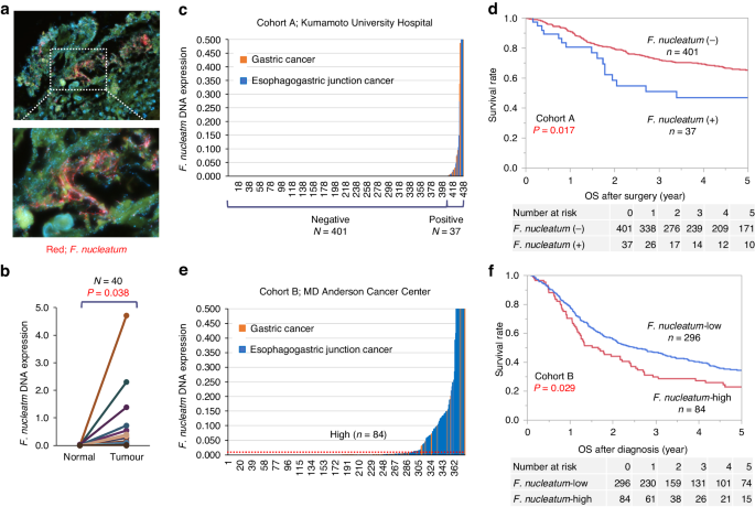 Presence of Fusobacterium nucleatum in relation to patient survival and an acidic environment in oesophagogastric junction and gastric cancers