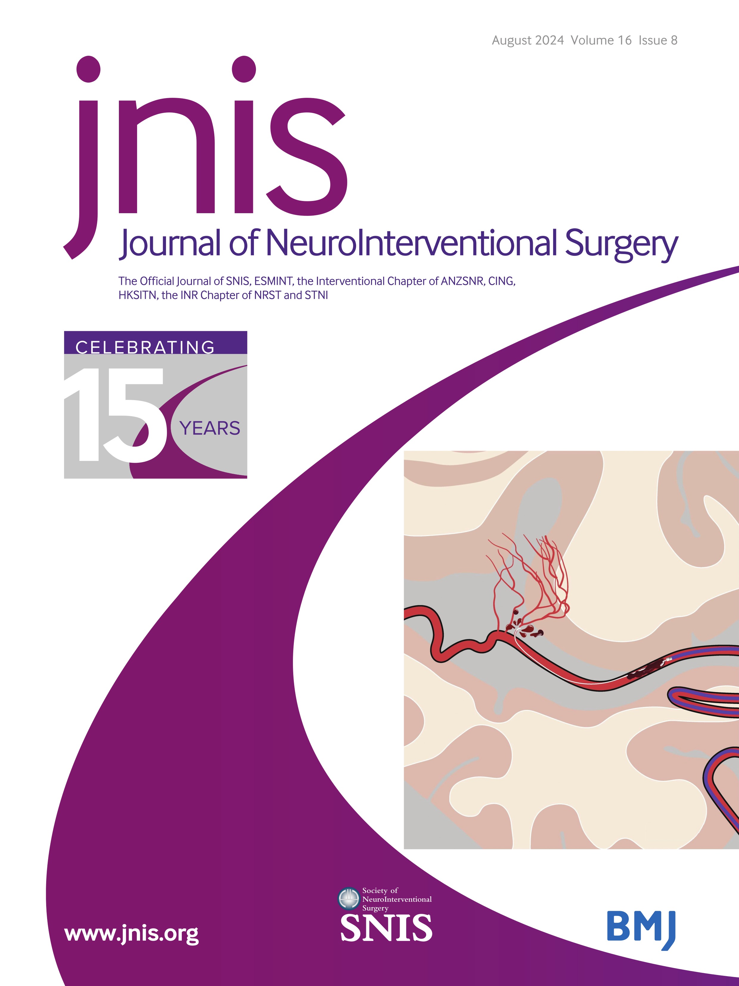 Circle of Willis integrity in acute middle cerebral artery occlusion: does the posterior communicating artery matter?