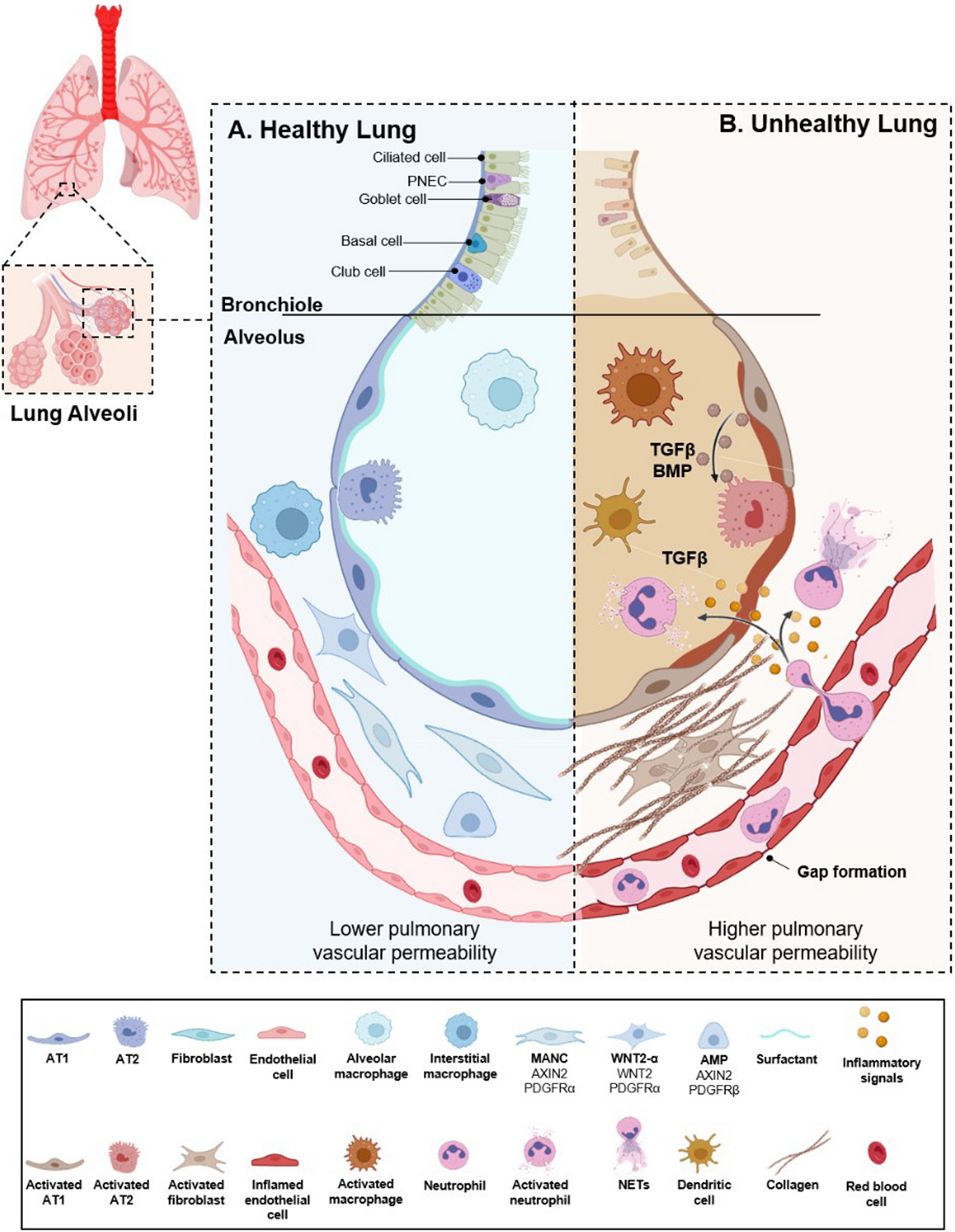 Cancer treatments as paradoxical catalysts of tumor awakening in the lung