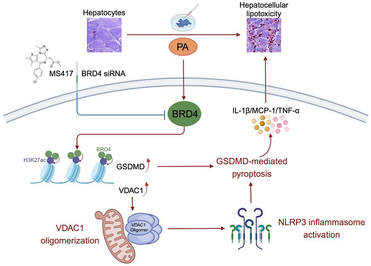 Targeting BRD4 mitigates hepatocellular lipotoxicity by suppressing the NLRP3 inflammasome activation and GSDMD-mediated hepatocyte pyroptosis