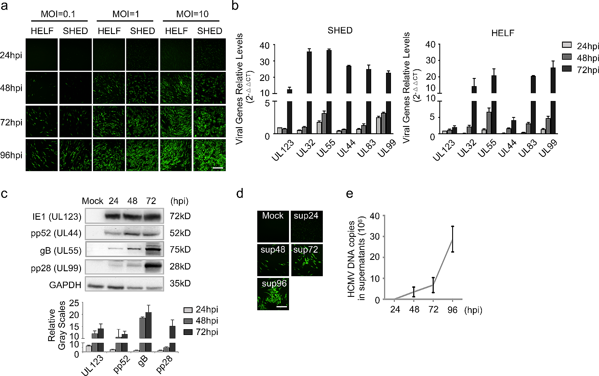 Human cytomegalovirus infection impairs neural differentiation via repressing sterol regulatory element binding protein 2-mediated cholesterol biosynthesis