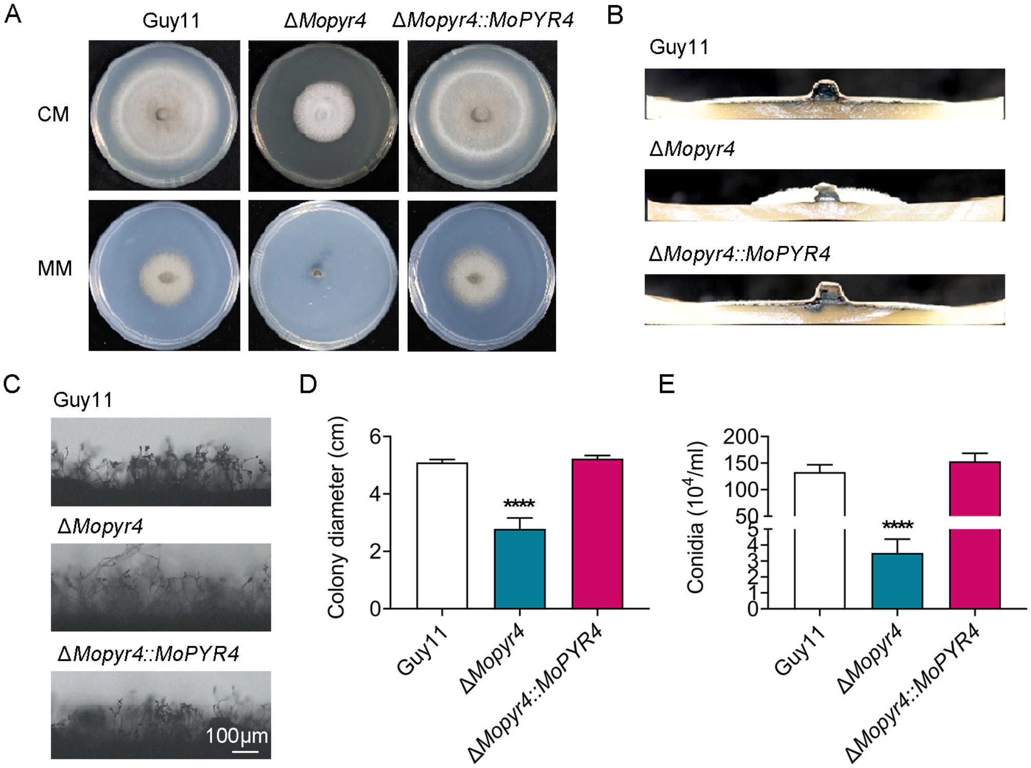 Dihydroorotase MoPyr4 is required for development, pathogenicity, and autophagy in rice blast fungus