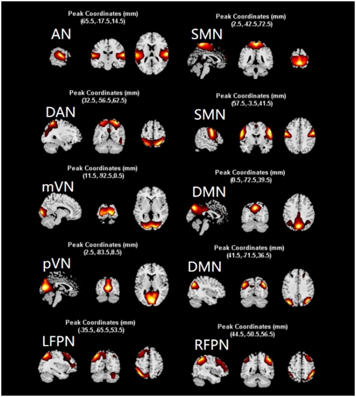 Dynamic functional network connectivity in patients with a mismatch between white matter hyperintensity and cognitive function