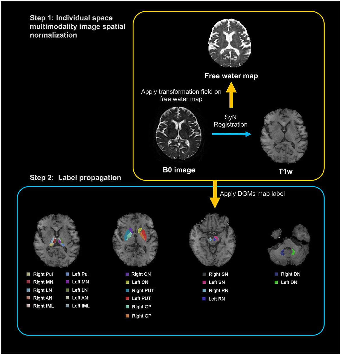 Quantifying neuroinflammation within deep gray matter in small vessel disease using diffusion tensor based free-water imaging: a longitudinal study