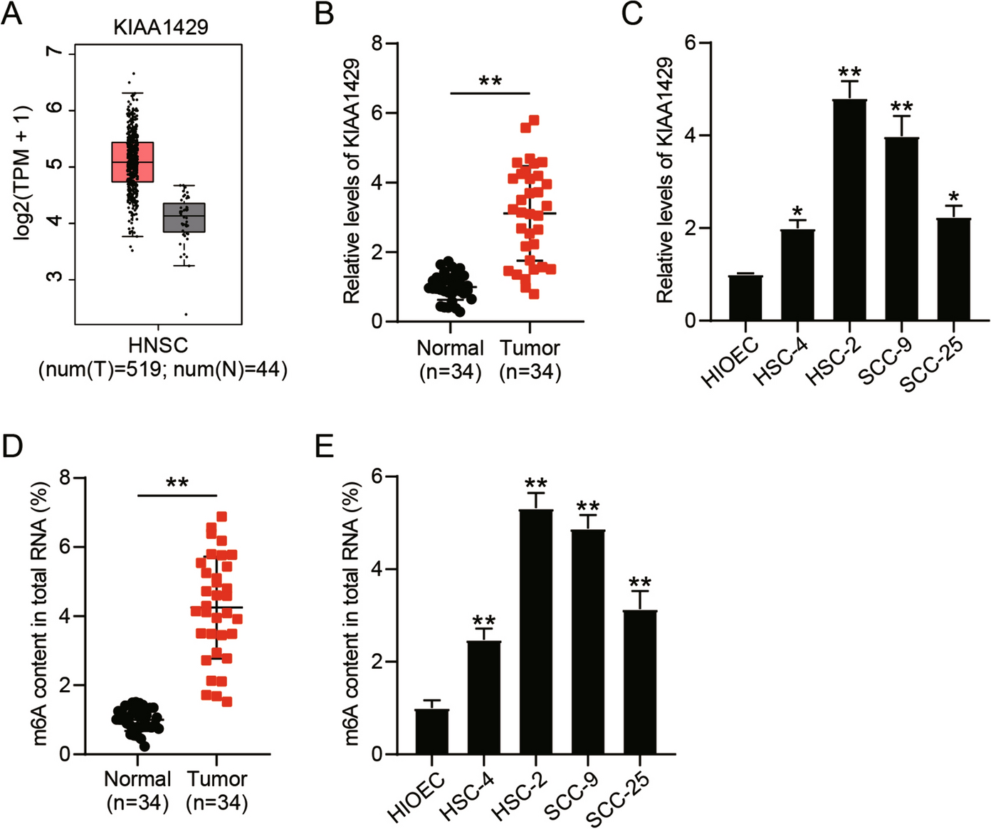KIAA1429 promotes the malignancy of oral squamous cell carcinoma by regulating CA9 m6A methylation