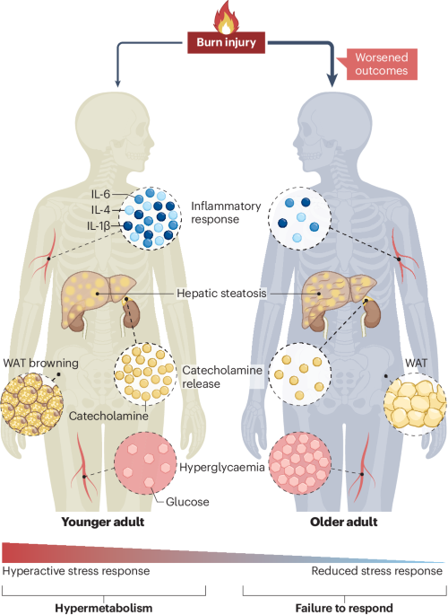 Post-burn endocrine–immune dynamics and ageing considerations