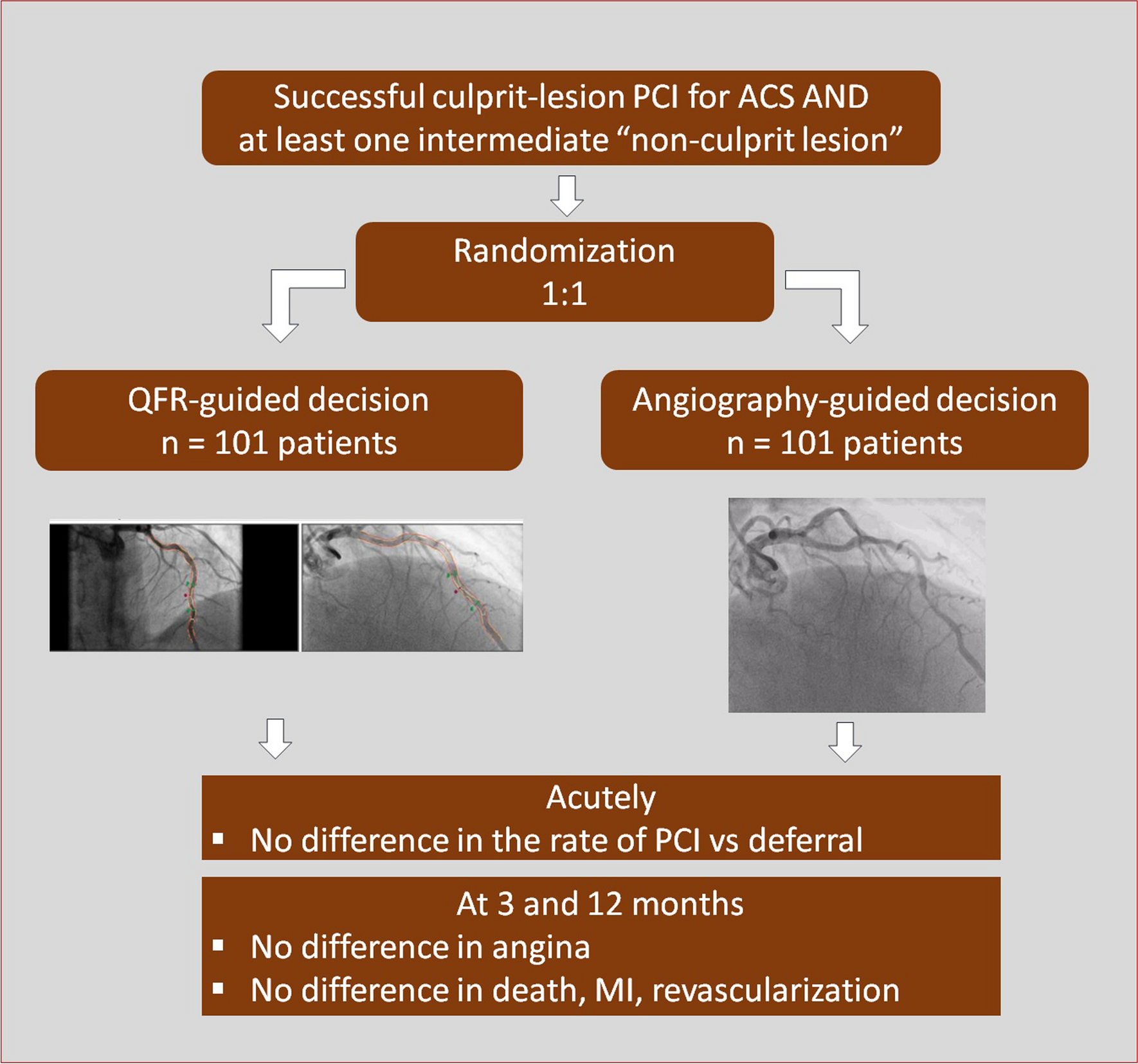 Quantitative flow ratio or angiography for the assessment of non-culprit lesions in acute coronary syndromes, a randomized trial