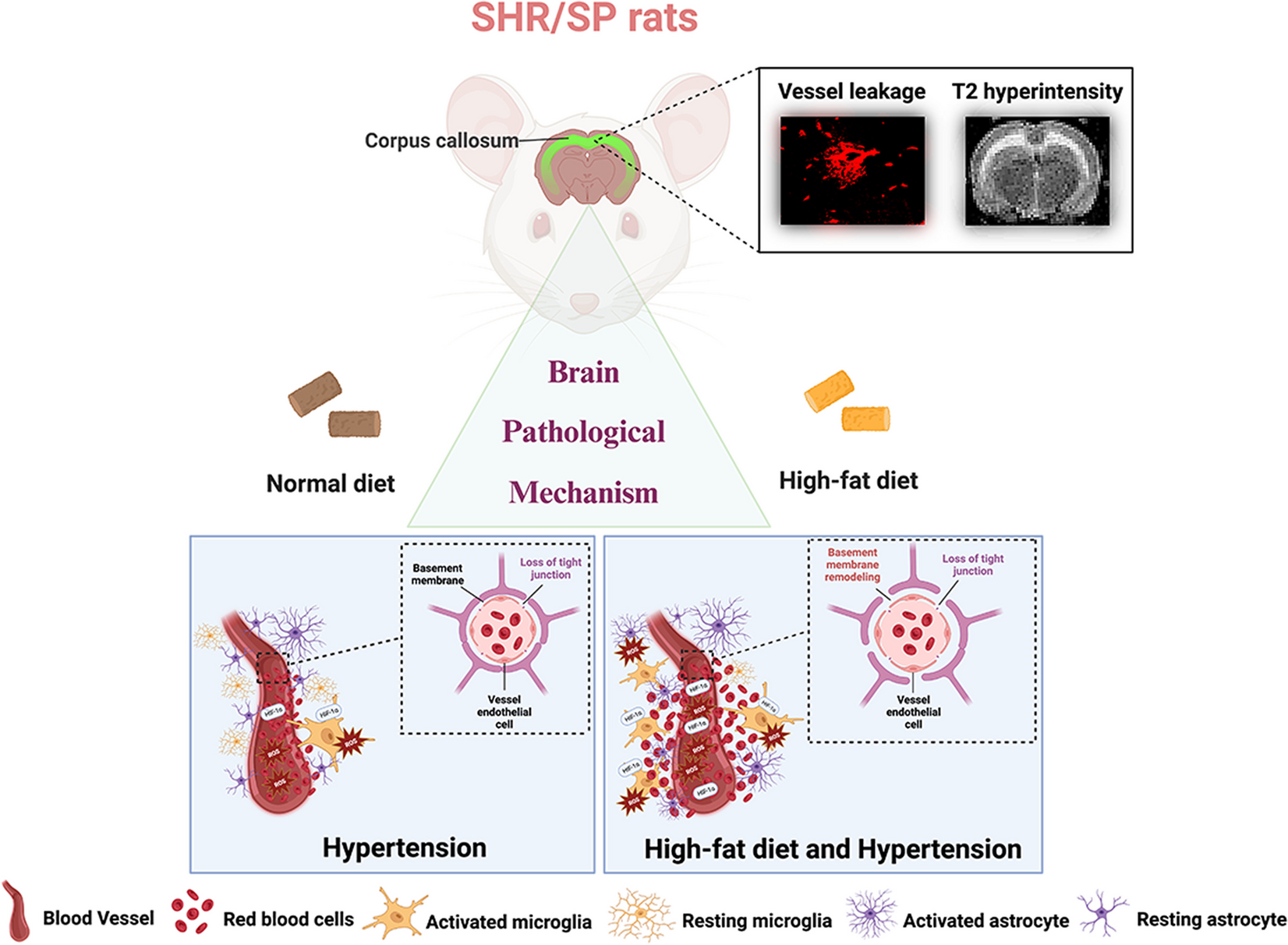 Effect of high-fat diet on cerebral pathological changes of cerebral small vessel disease in SHR/SP rats