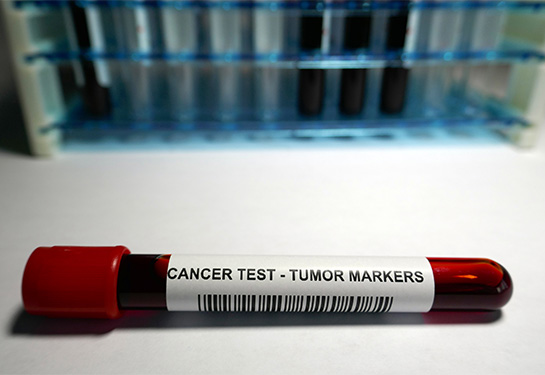 California cancer patients now have greater access to life-saving biomarker testing