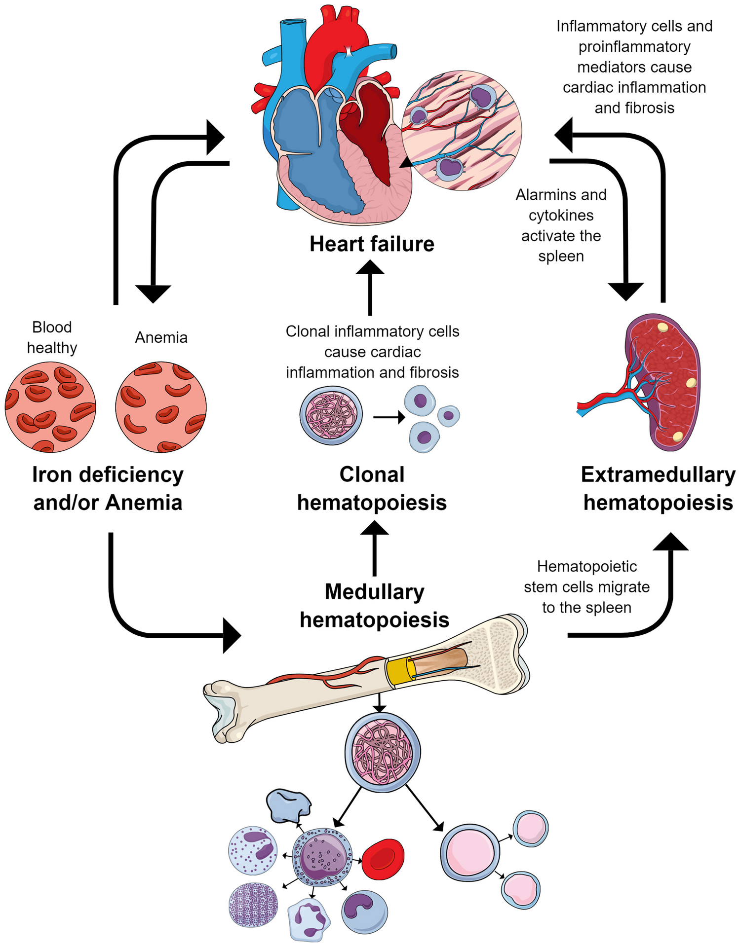 Interplay of the heart, spleen, and bone marrow in heart failure: the role of splenic extramedullary hematopoiesis