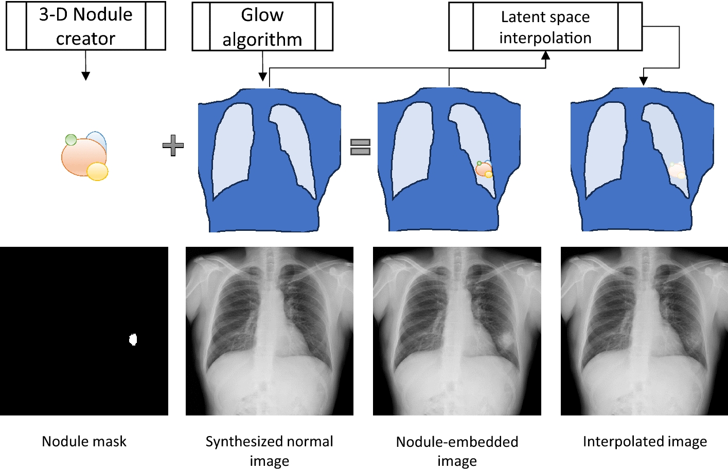 Detection of pulmonary nodules in chest radiographs: novel cost function for effective network training with purely synthesized datasets