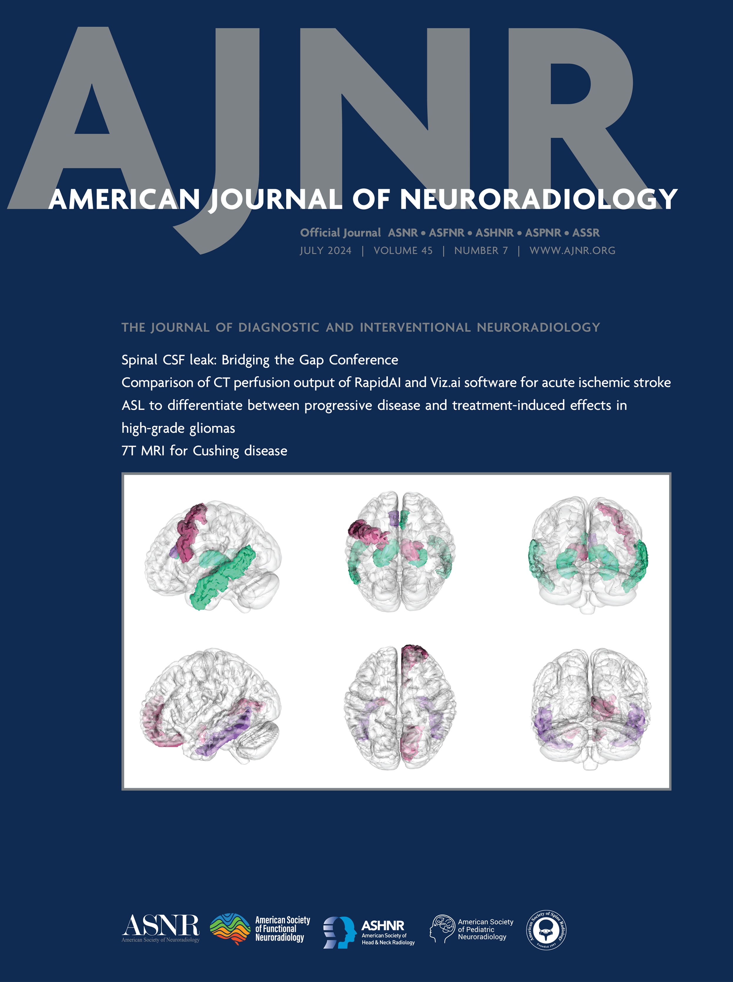 7T MRI for Cushing Disease: A Single-Institution Experience and Literature Review [HEAD AND NECK IMAGING]