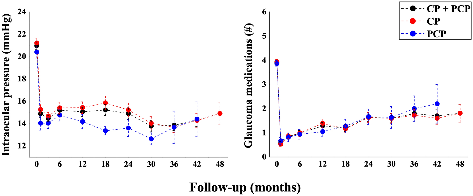 Long-term outcomes of canaloplasty and phaco-canaloplasty in the treatment of open angle glaucoma: a single-surgeon experience