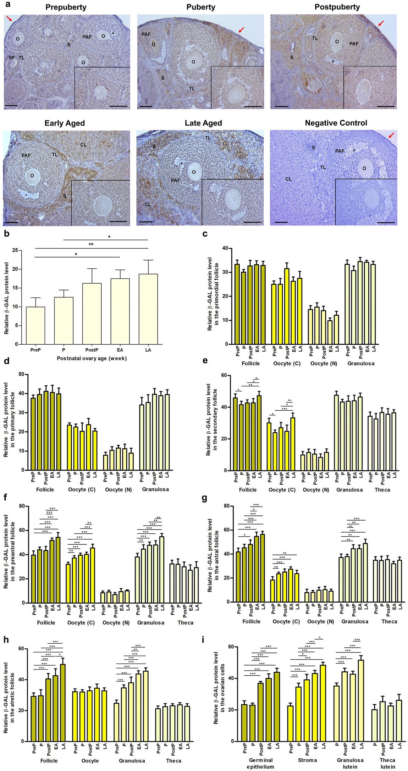 The DNA double-strand break repair proteins γH2AX, RAD51, BRCA1, RPA70, KU80, and XRCC4 exhibit follicle-specific expression differences in the postnatal mouse ovaries from early to older ages