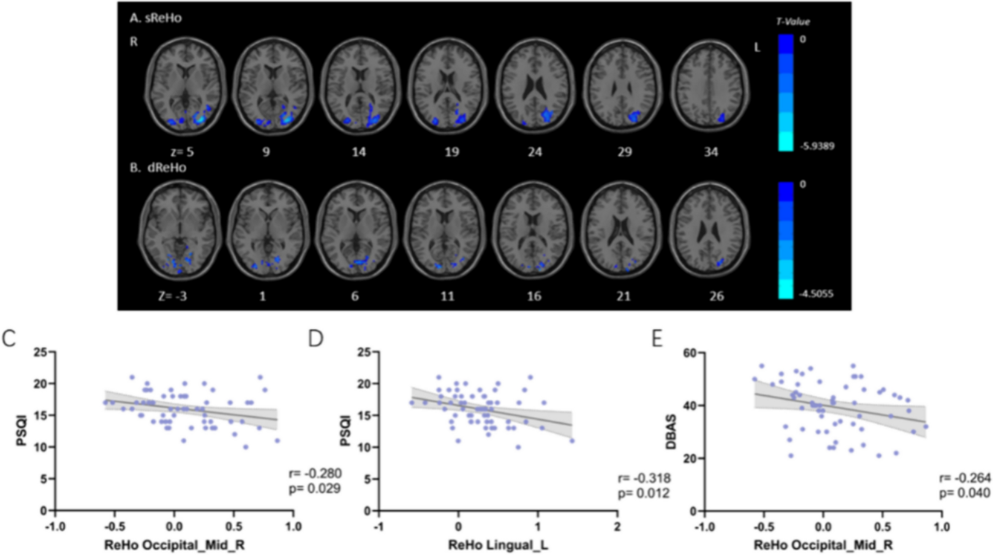 Static and temporal dynamic alterations of regional homogeneity in chronic insomnia: a resting-state fMRI study