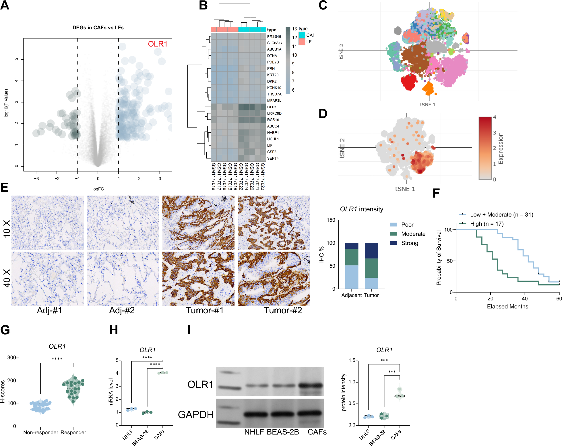 PRRX1-OLR1 axis supports CAFs-mediated lung cancer progression and immune suppression