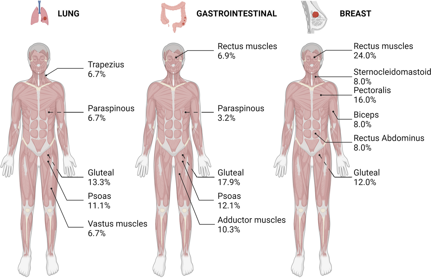 Striated muscle: an inadequate soil for cancers