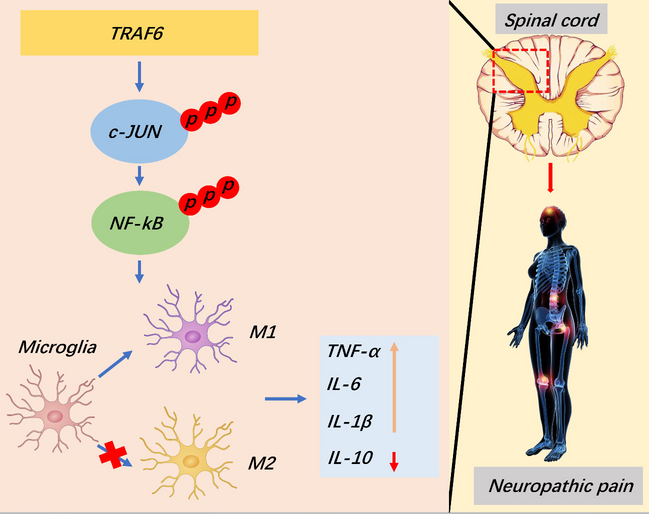 TRAF6 promotes spinal microglial M1 polarization to aggravate neuropathic pain by activating the c-JUN/NF-kB signaling pathway