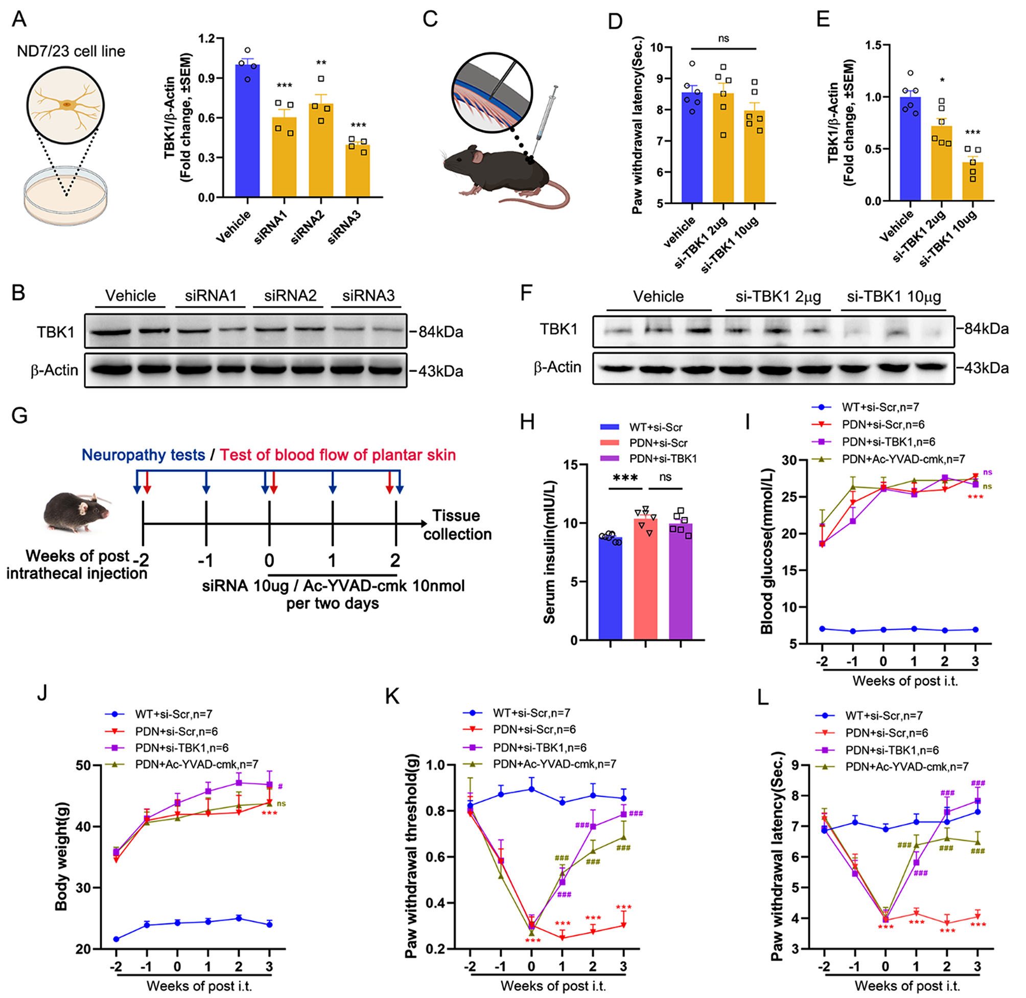 Targeting TANK-binding kinase 1 attenuates painful diabetic neuropathy via inhibiting microglia pyroptosis