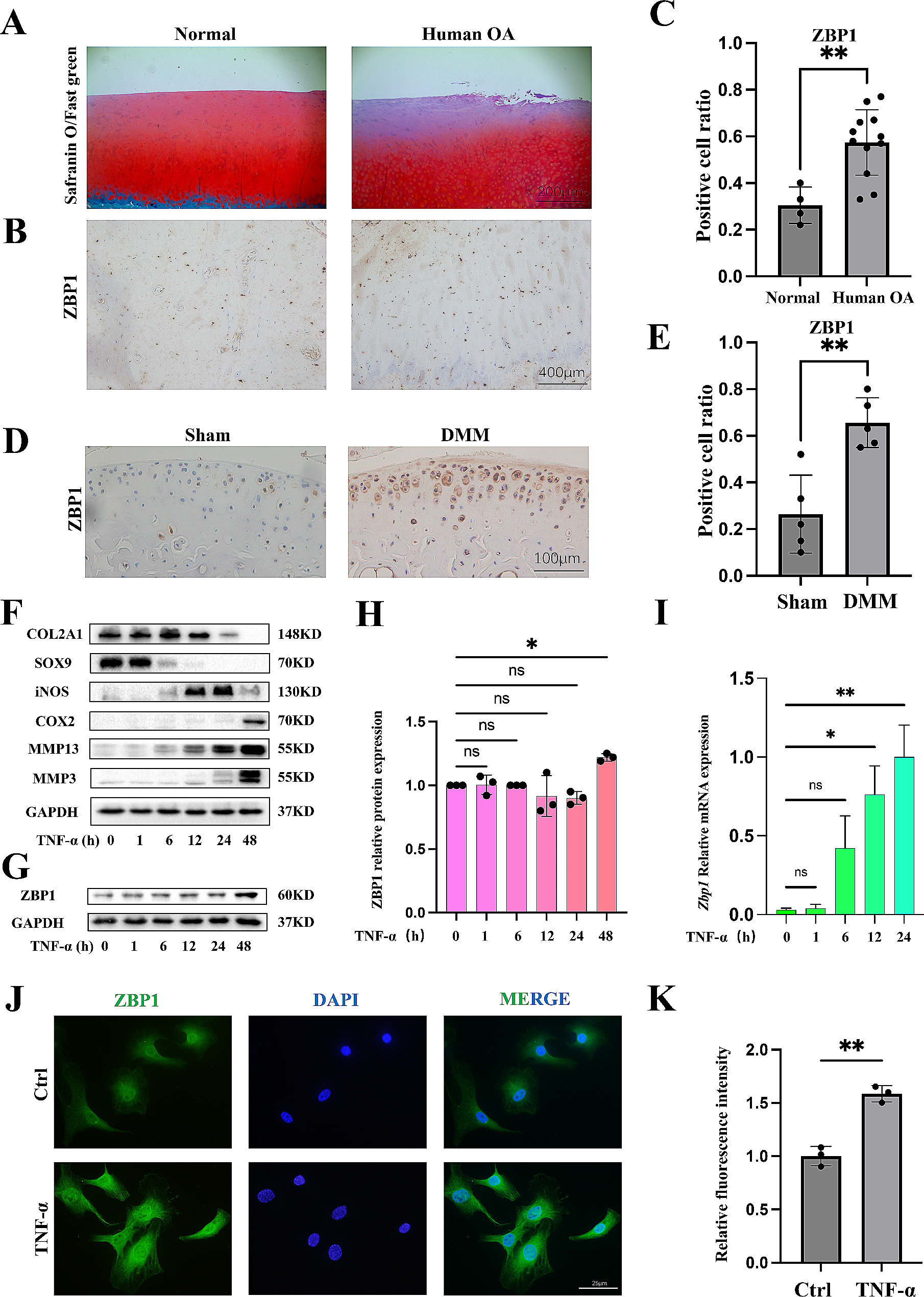 IRF1 regulation of ZBP1 links mitochondrial DNA and chondrocyte damage in osteoarthritis