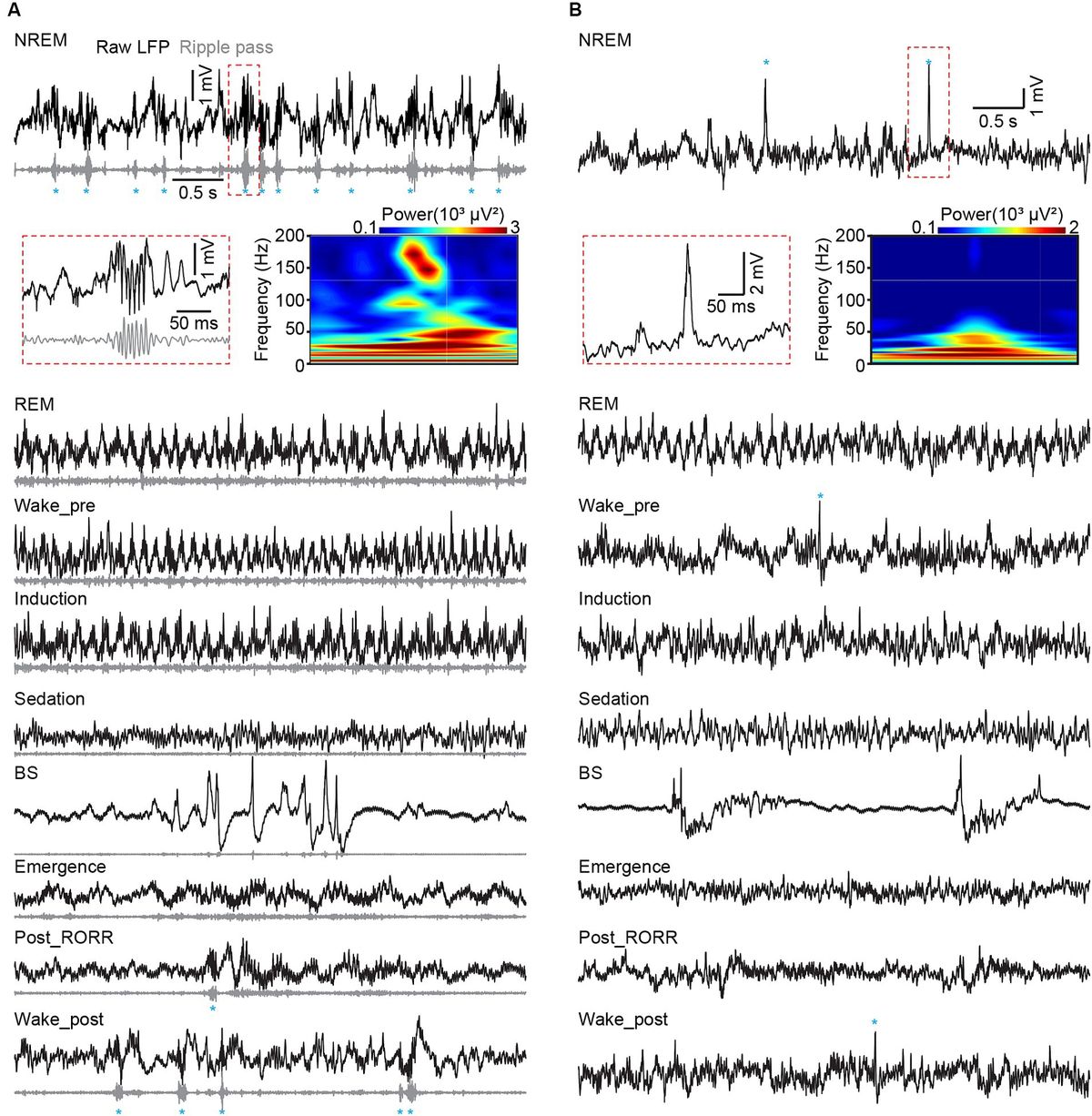 Electrophysiological activity pattern of mouse hippocampal CA1 and dentate gyrus under isoflurane anesthesia