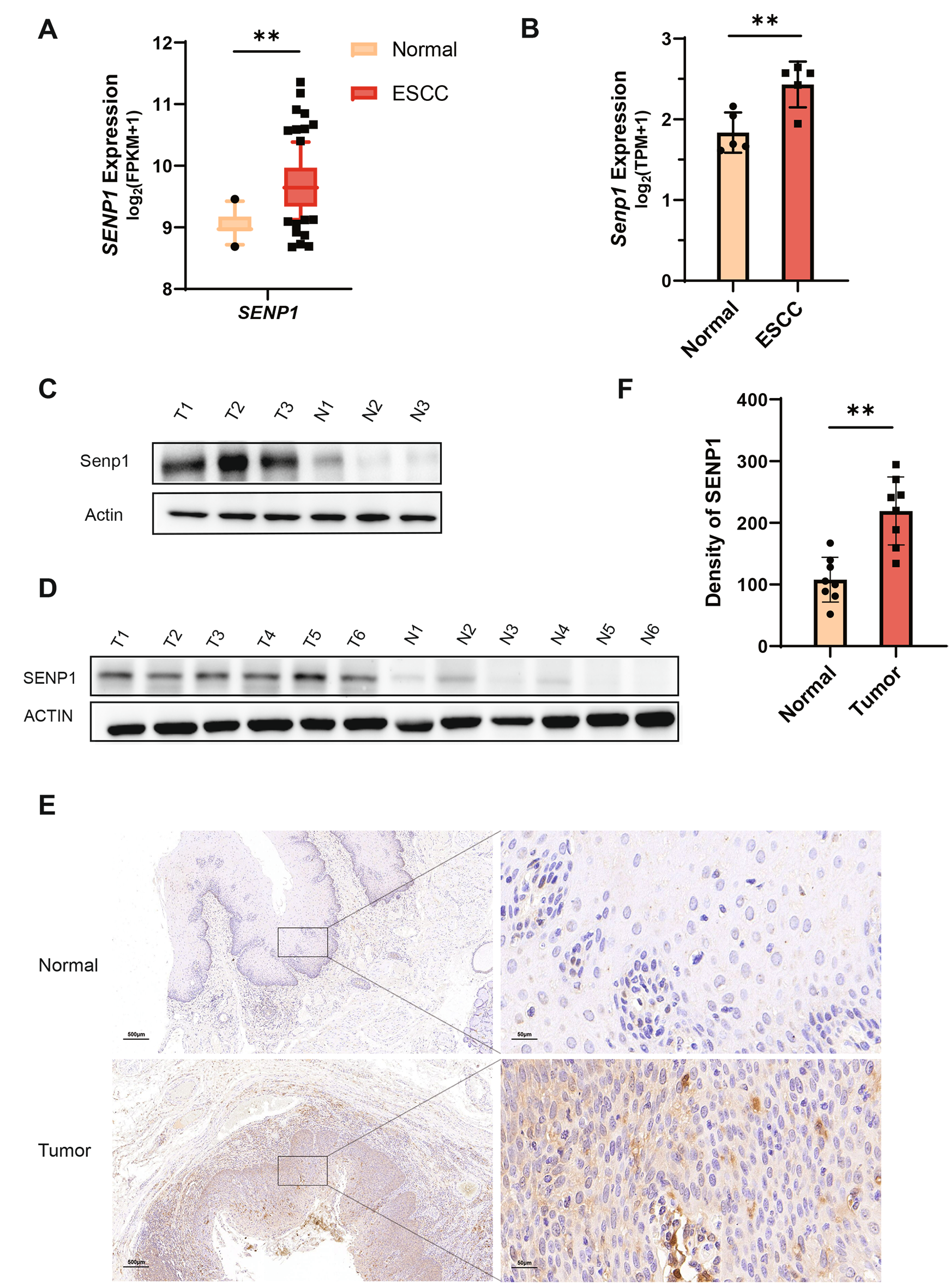 Suppressing SENP1 inhibits esophageal squamous carcinoma cell growth via SIRT6 SUMOylation