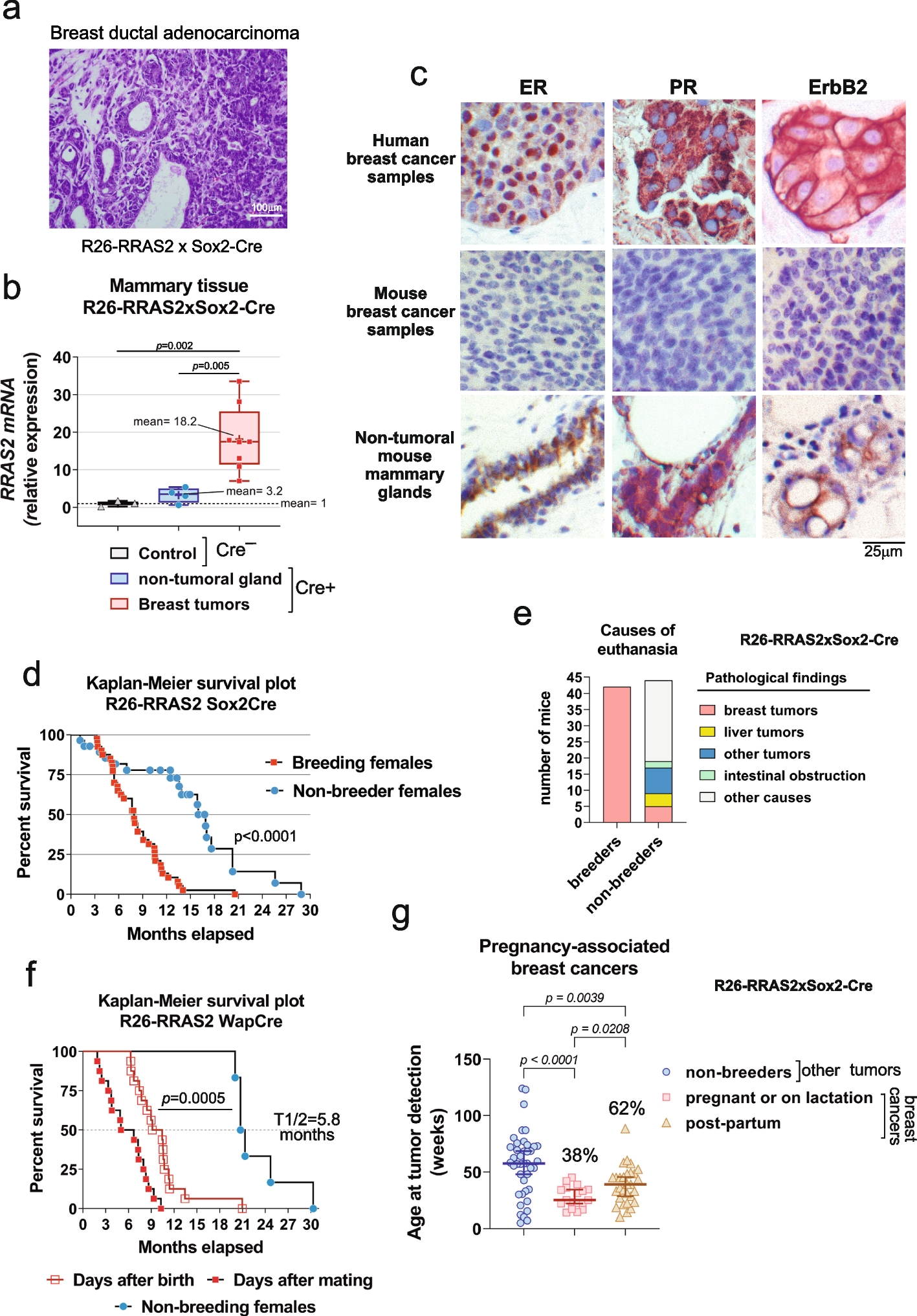 Unmutated RRAS2 emerges as a key oncogene in post-partum-associated triple negative breast cancer