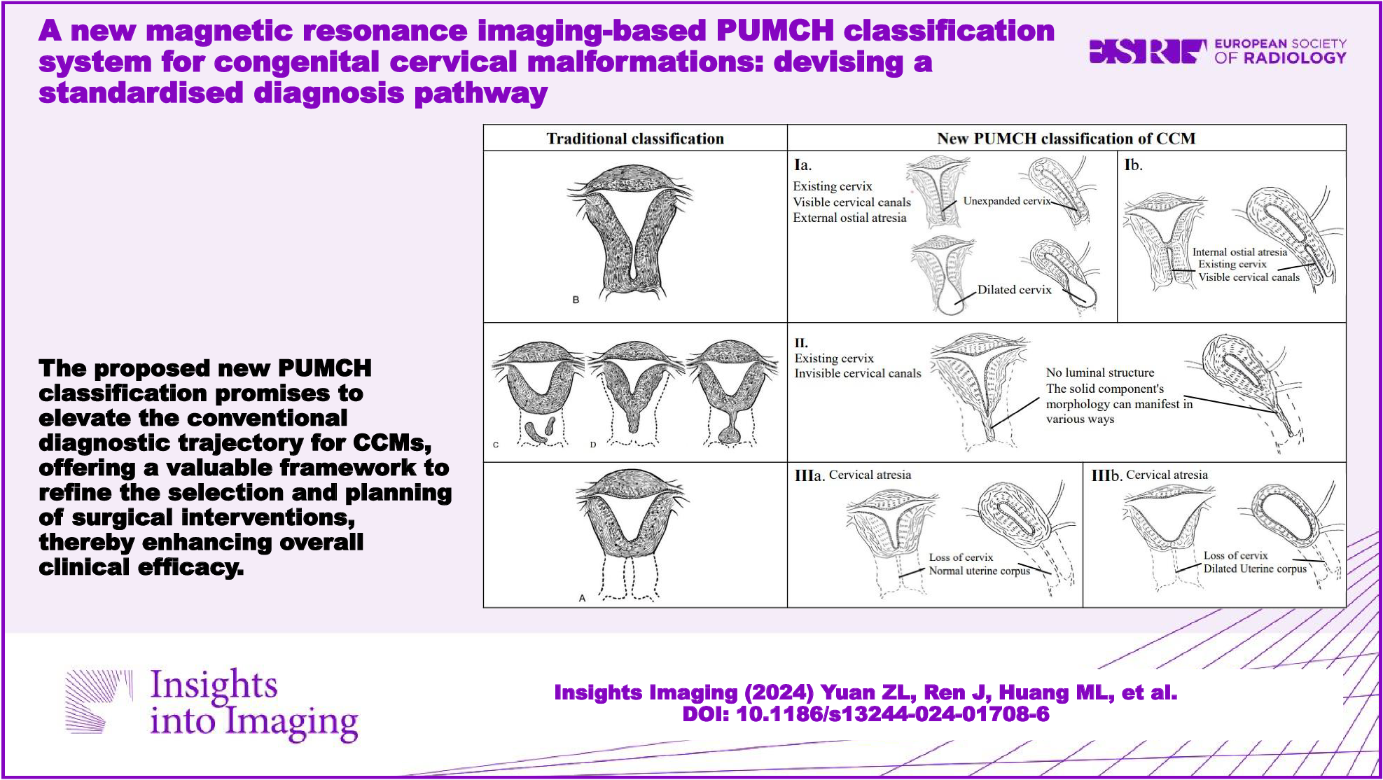 A new magnetic resonance imaging-based PUMCH classification system for congenital cervical malformations: devising a standardised diagnosis pathway