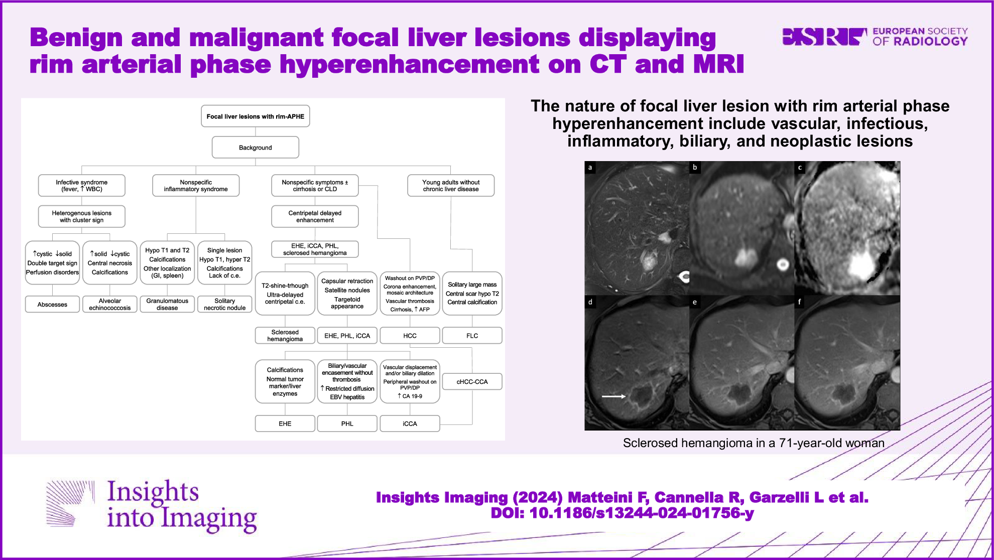 Benign and malignant focal liver lesions displaying rim arterial phase hyperenhancement on CT and MRI