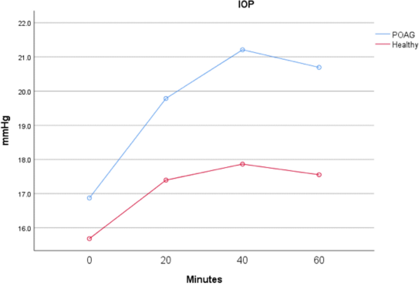 OCT angiographic evaluation of changes in macula and optic nerve head vessel density after a water drinking test in glaucomatous and healthy eyes