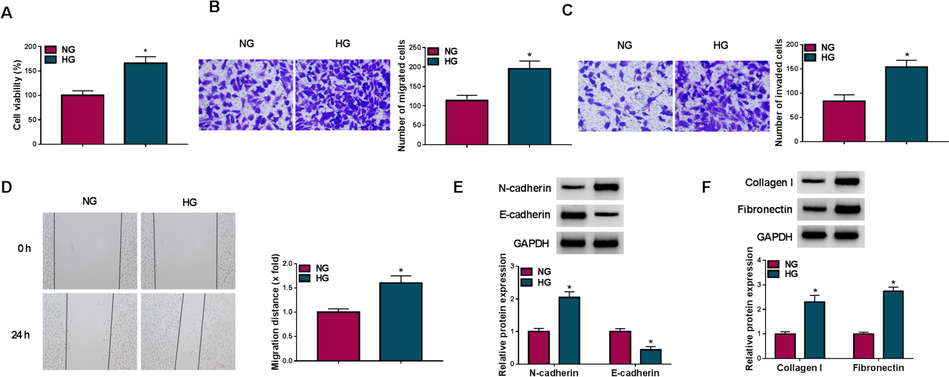 SP1 promotes high glucose-induced lens epithelial cell viability, migration and epithelial-mesenchymal transition via regulating FGF7 and PI3K/AKT pathway