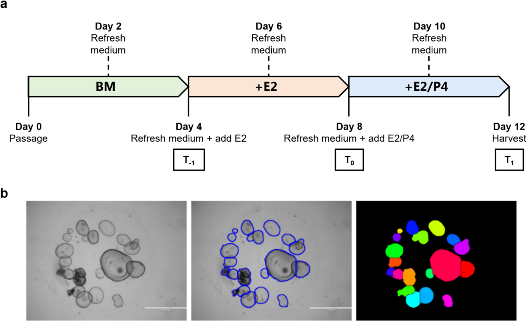 Enrichment of cell cycle pathways in progesterone-treated endometrial organoids of infertile women compared to fertile women