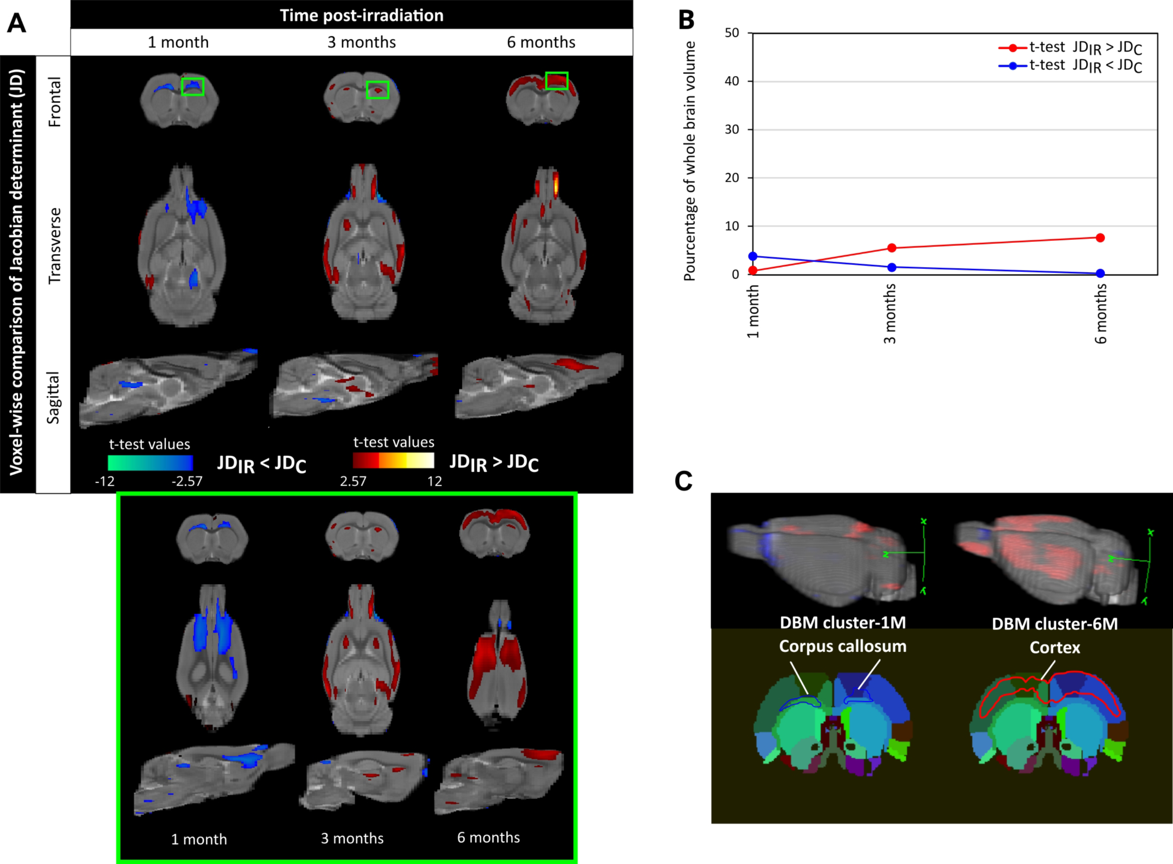 Deformation-based morphometry: a sensitive imaging approach to detect radiation-induced brain injury?