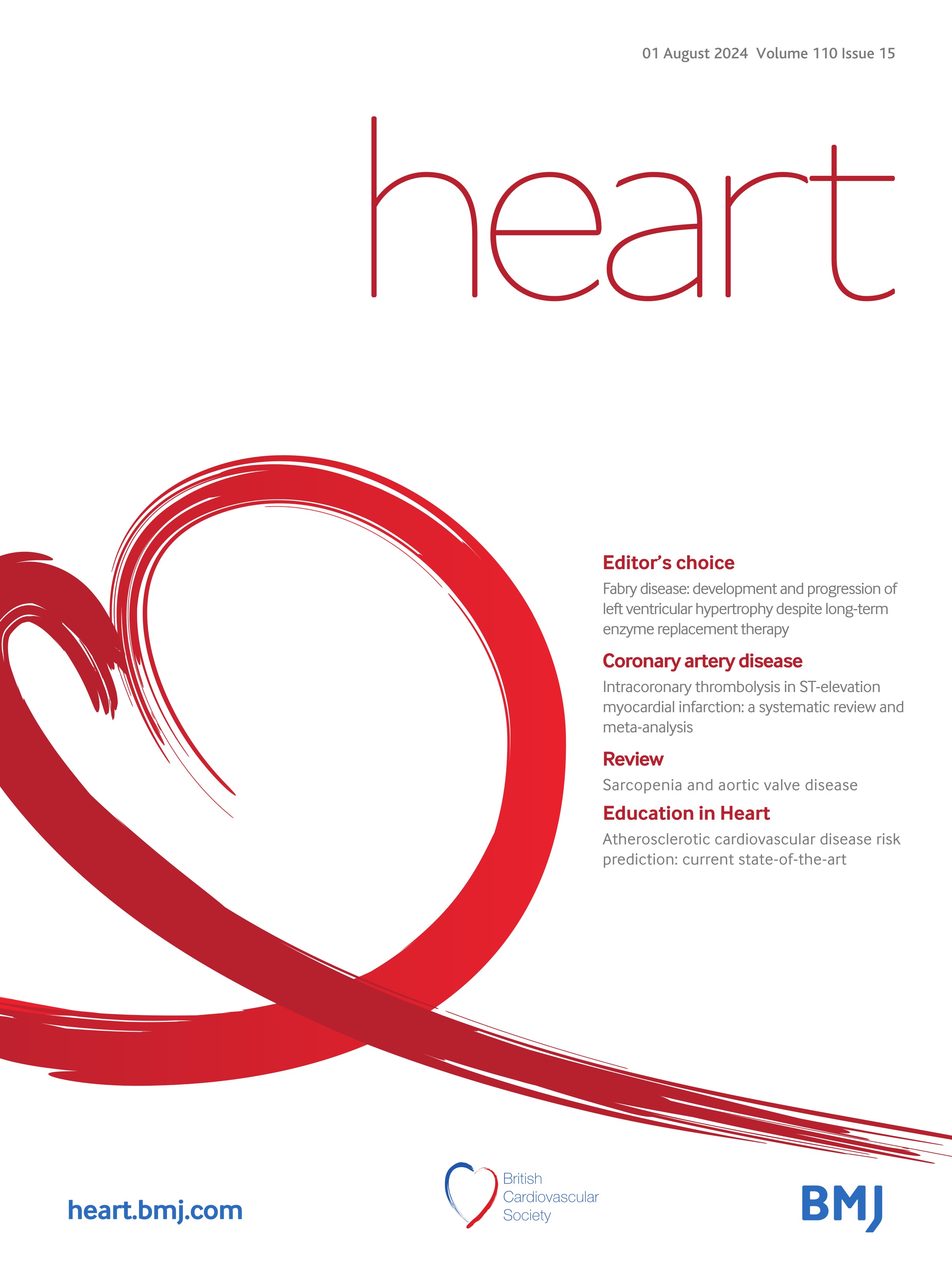 Fabry disease: development and progression of left ventricular hypertrophy despite long-term enzyme replacement therapy