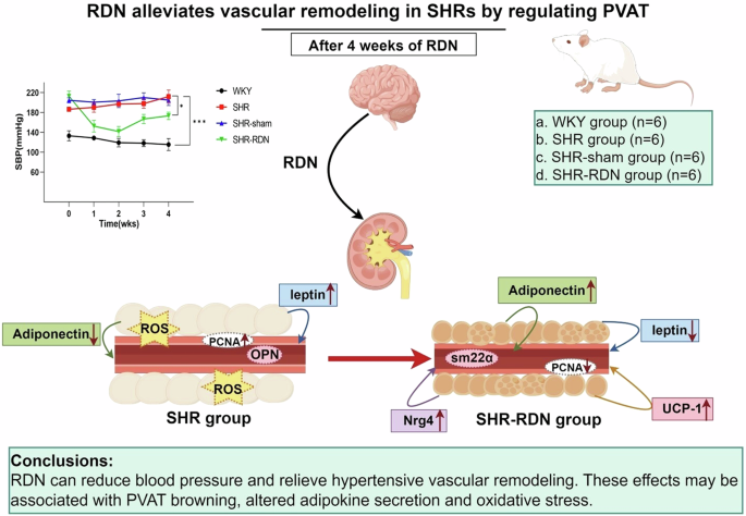 Renal denervation alleviates vascular remodeling in spontaneously hypertensive rats by regulating perivascular adipose tissue