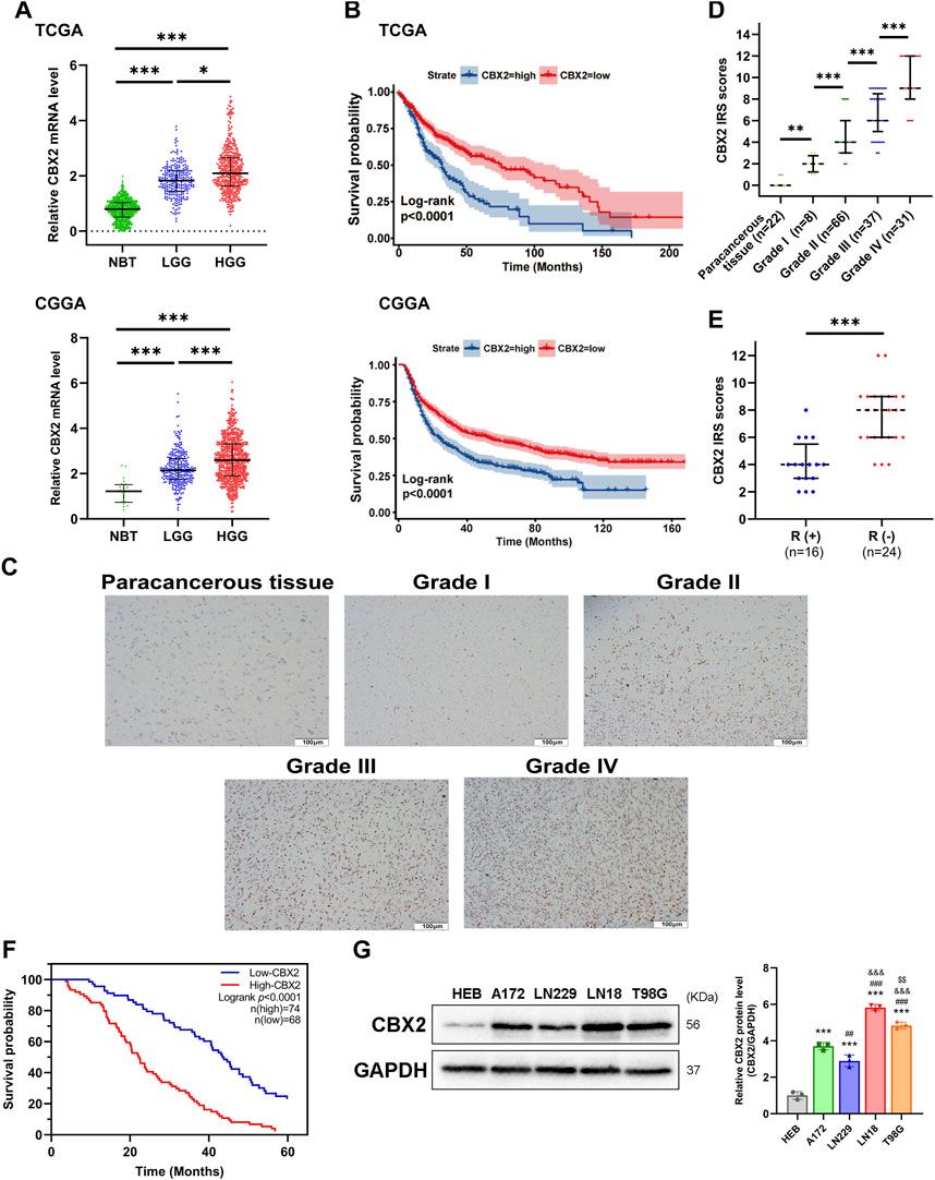 CBX2 enhances the progression and TMZ chemoresistance of glioma via EZH2-mediated epigenetic silencing of PTEN expression