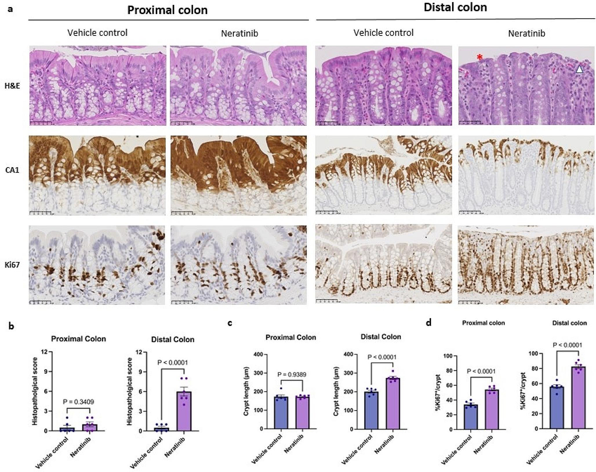 Ferroptosis – a potential feature underlying neratinib-induced colonic epithelial injury