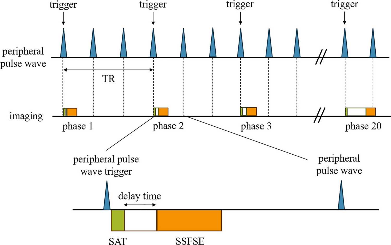 Clinical application of single-shot fast spin-echo sequence for cerebrospinal fluid flow MR imaging