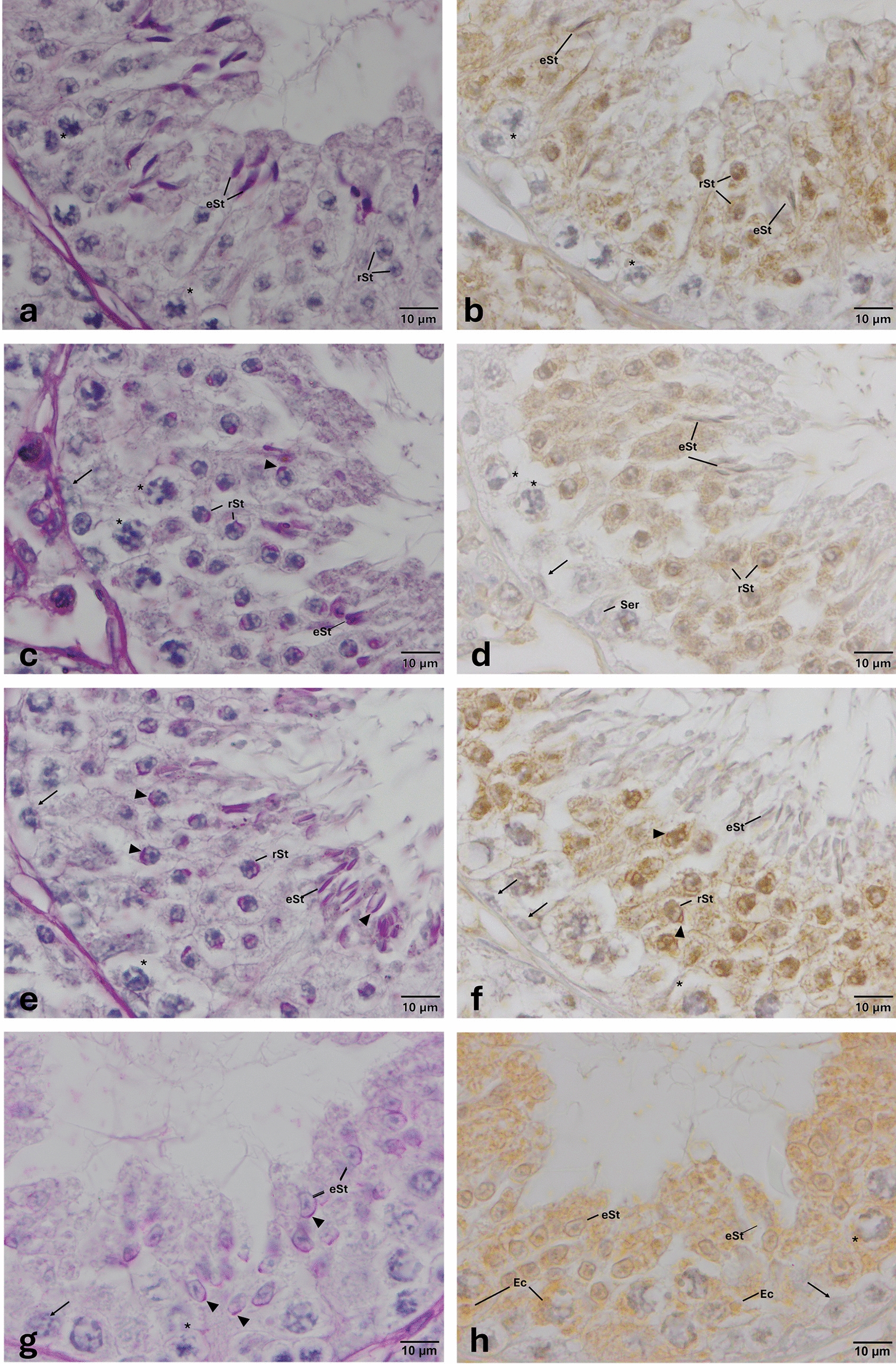 Stage-specific expression of Toll-like receptors in the seminiferous epithelium of mouse testis