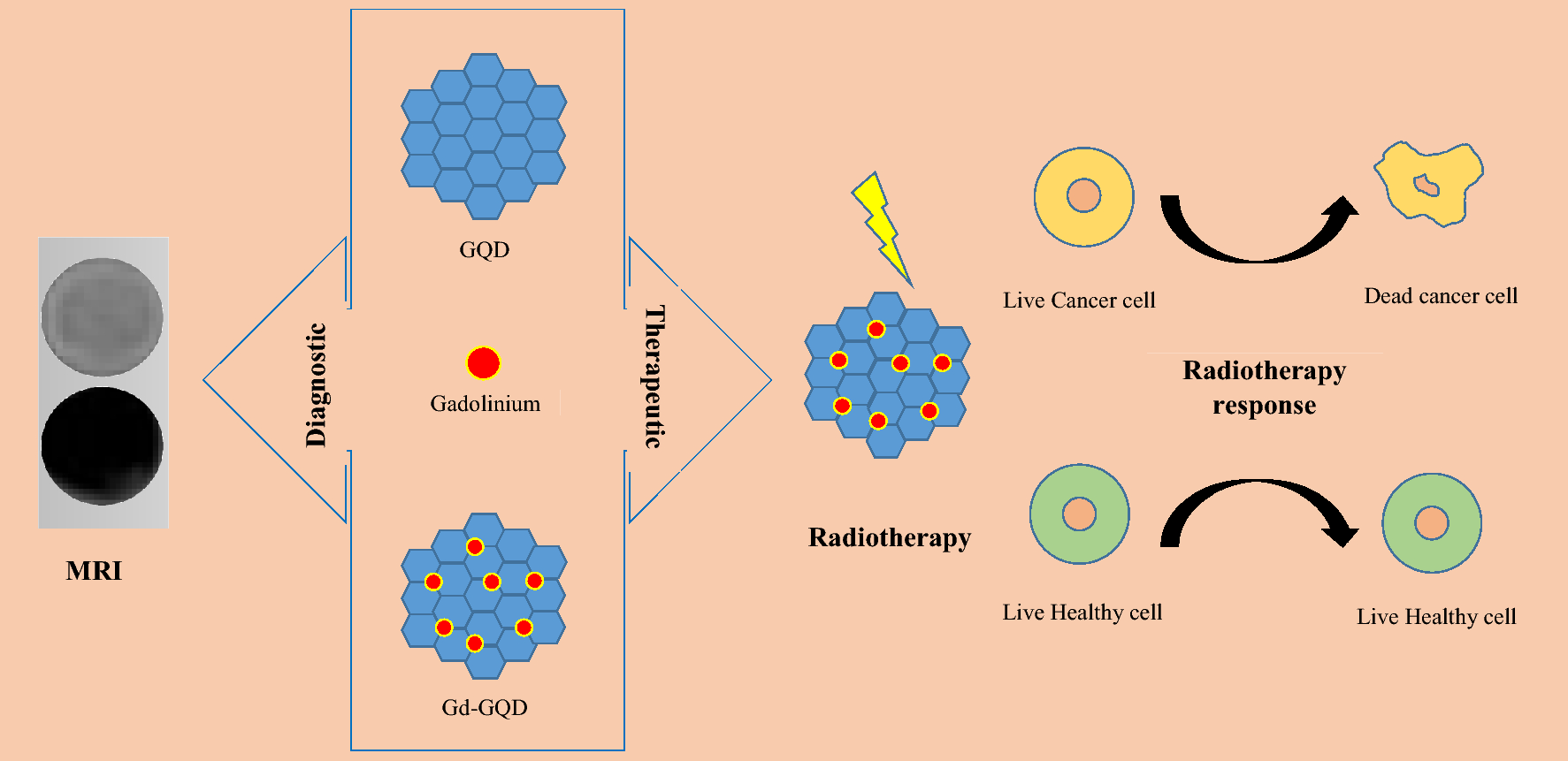 Gd-GQDs as nanotheranostic platform for the treatment of HPV-positive oropharyngeal cancer