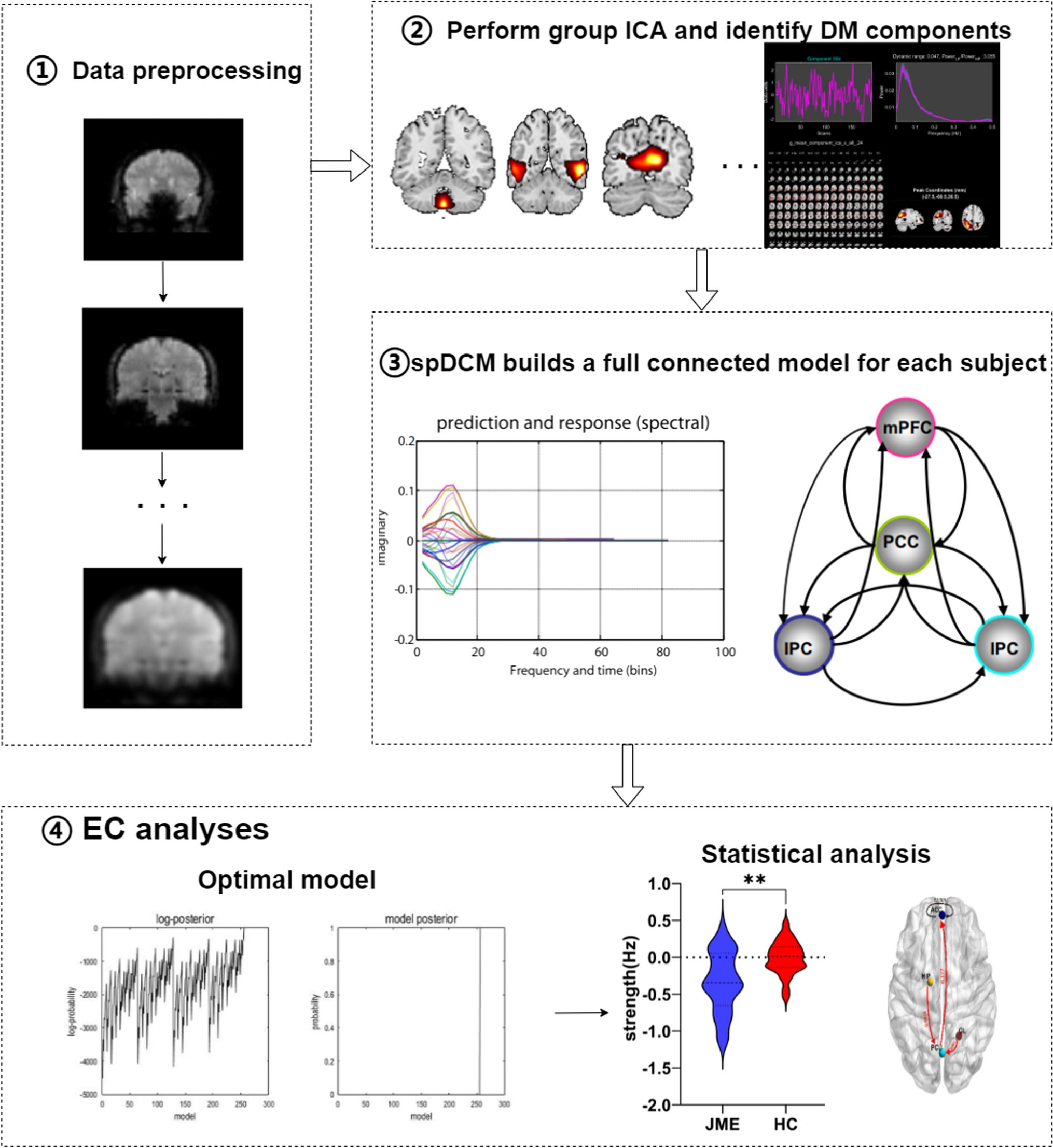 Altered effective connectivity of the default mode network in juvenile myoclonic epilepsy