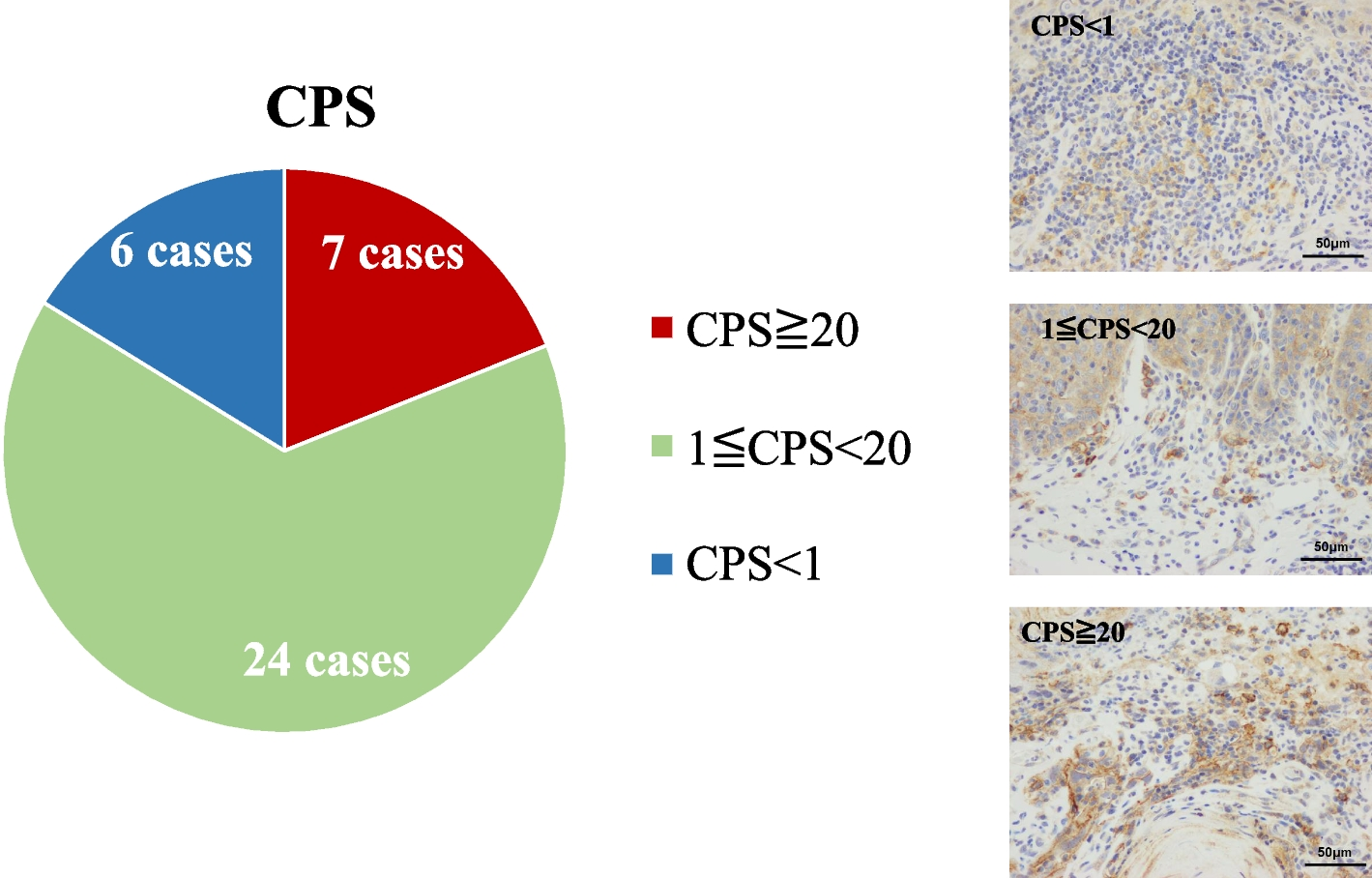 Pathological examination of factors involved in PD-L1 expression in patients with oral tongue squamous cell carcinoma