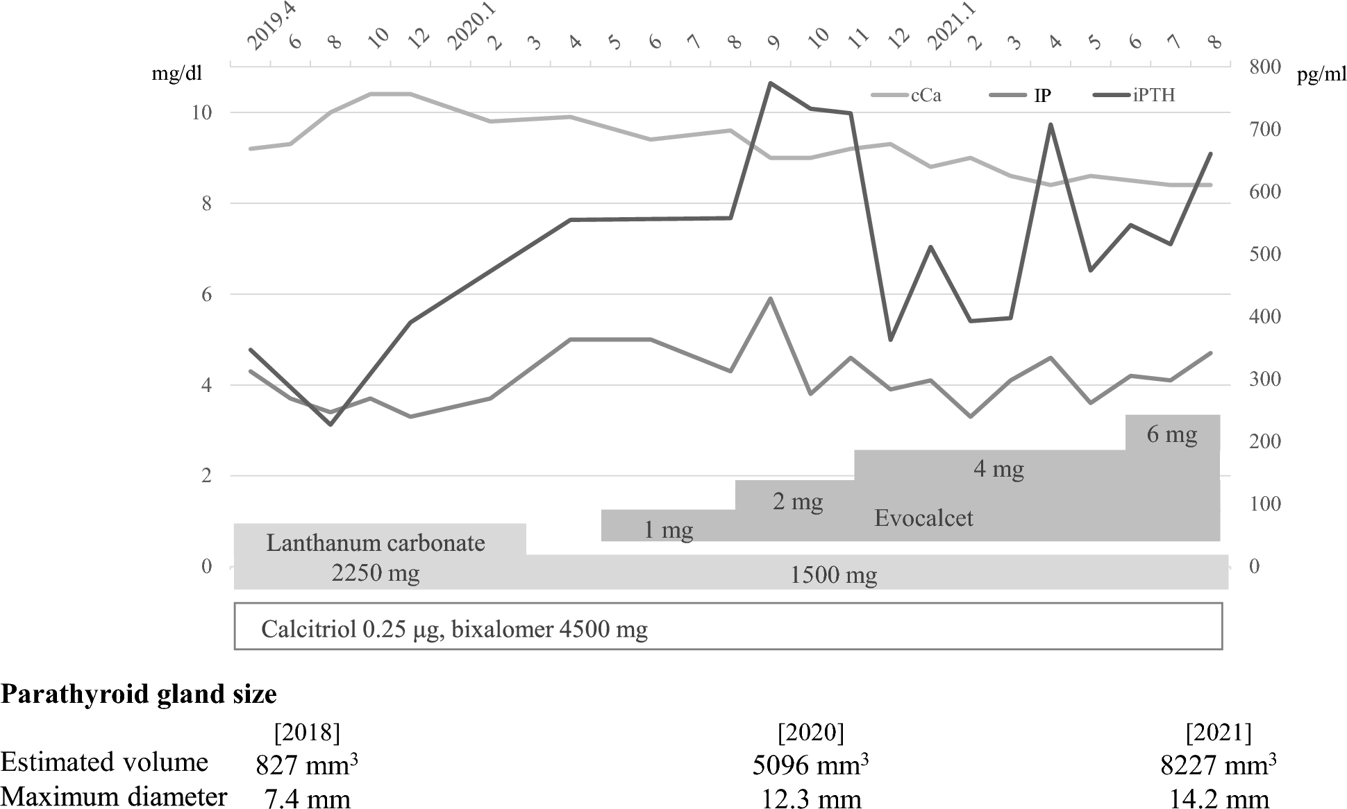 Parathyroid carcinoma in a dialysis patient definitively diagnosed after parathyroidectomy for uncontrolled secondary hyperparathyroidism